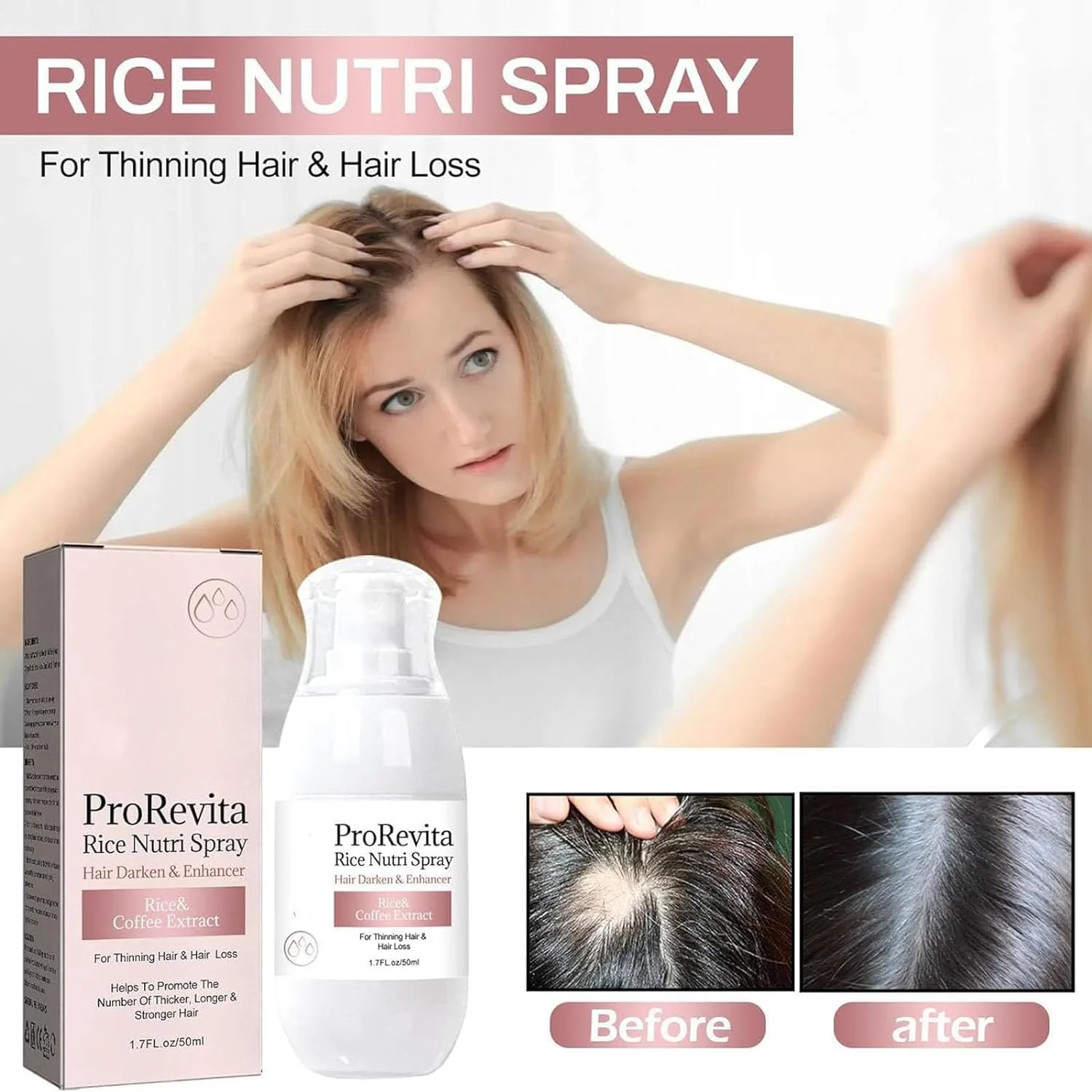 اسپری تقویت کننده مو زپتا اچ-ریگرو 2.0، اسپری کمک کننده مو بلو، اسپری مغذی برنج پرورویتا، مناسب برای خانم ها و آقایان، 2 عدد