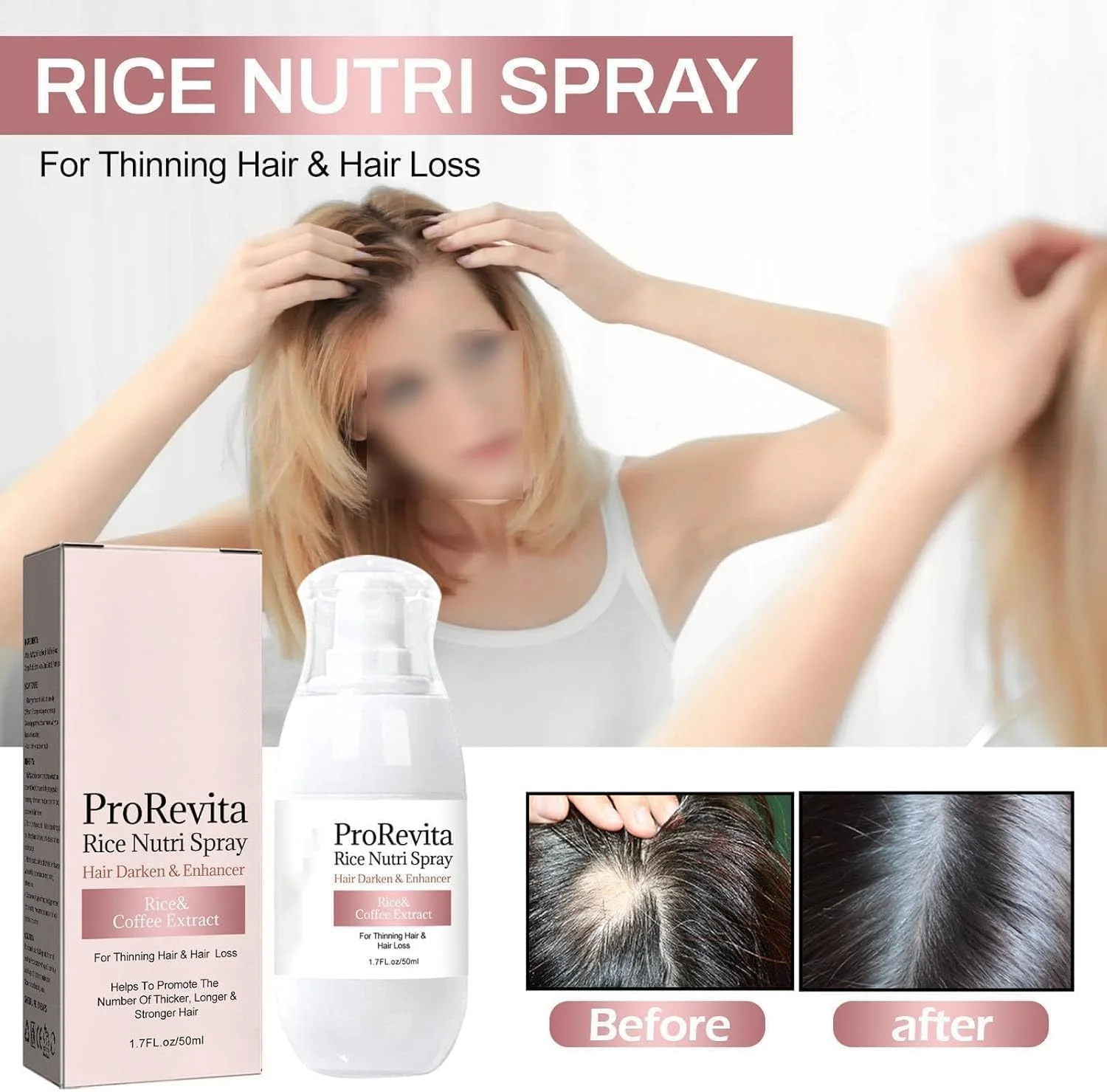 اسپری مراقبت از مو زپتا H-Regrow 2.0، اسپری مغذی برنج پرورویتا، اسپری کمک کننده مو Bello، احیا کننده و رشد مجدد، اسپری مراقبت از مو برای موهای نازک و ریزش مو (1 عدد)