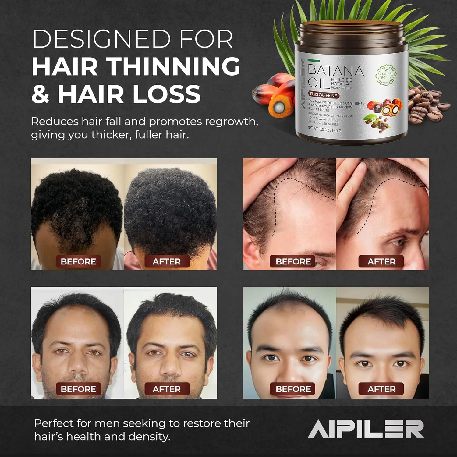 روغن باتانا برای تقویت مو: روغن درمانی مو هندوراس 100% خالص و خام دکتر سبی - مراقبت از مو قبل یا بعد از حمام برای موهای فر/مجعد/موج دار 150 گرم (کافئین)