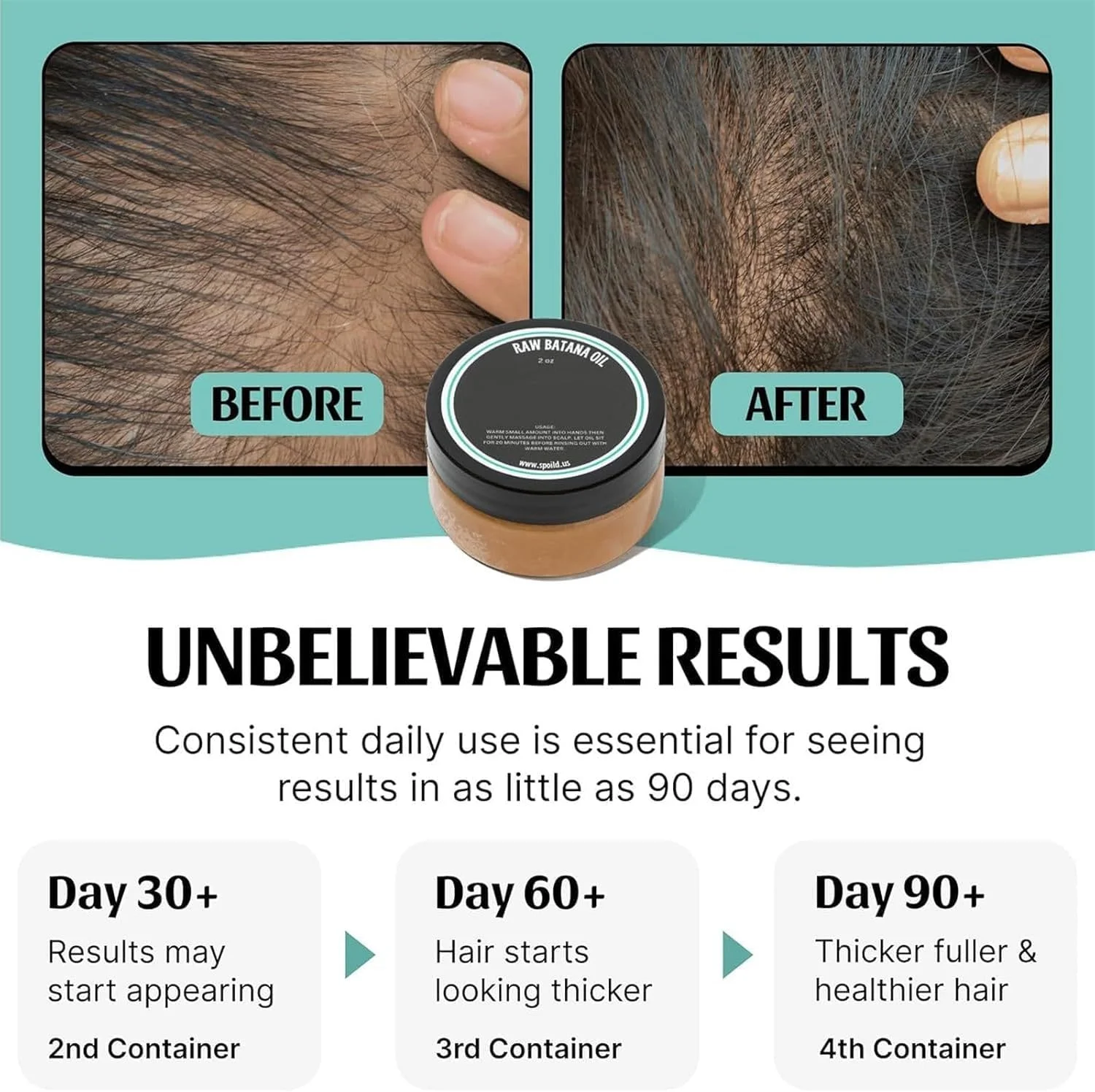 روغن باتانا آزونی برای رشد مو، درمان مغذی برای موهای خشک، آسیب دیده و نازک، تقویت کننده موهای ضخیم تر، قوی تر و سالم تر با درمان درخشان (59 گرم) روغن باتانا آزونی برای رشد مو، درمان مغذی برای موهای خشک، آسیب دیده و نازک، تقویت کننده موهای ضخیم تر، قوی تر و سالم تر با درمان درخشان (59 گرم)