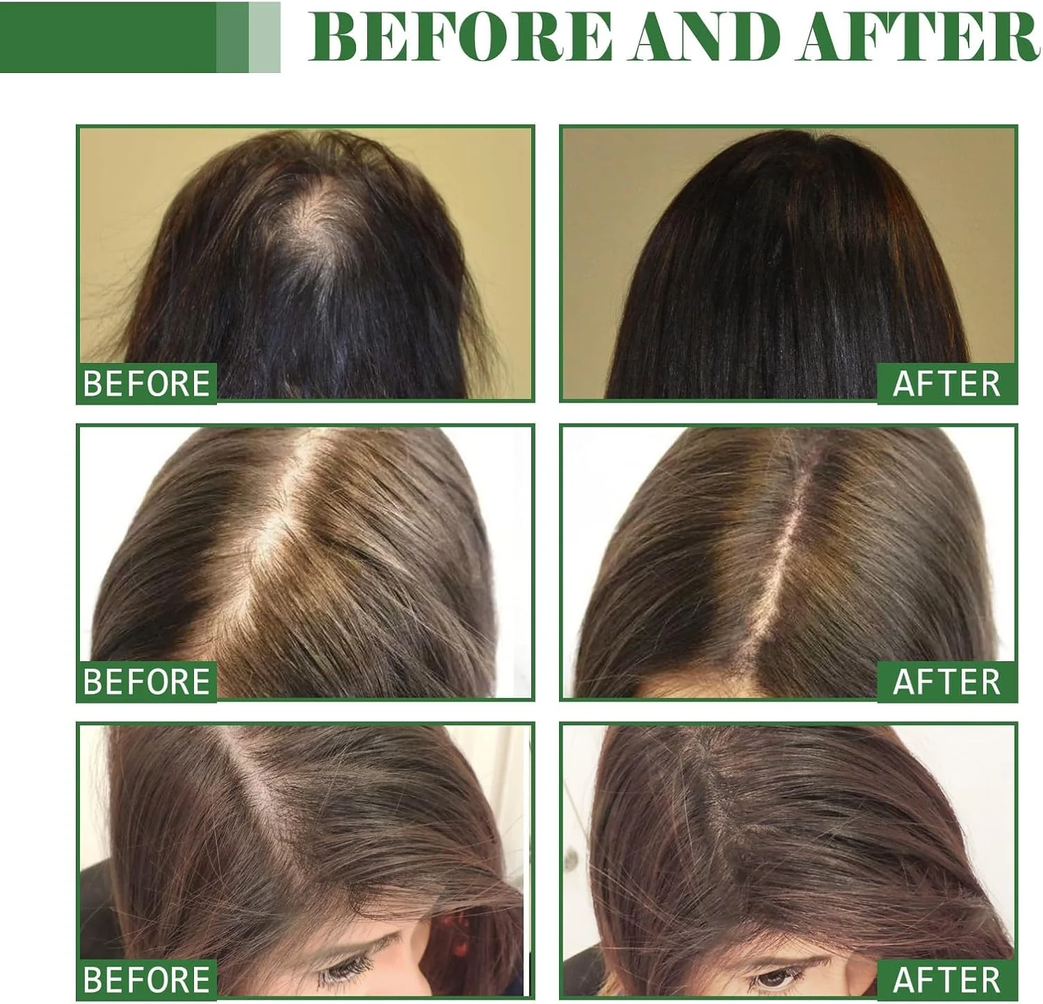 روغن باتانا برای رشد مو، روغن ۱۰۰٪ خالص و طبیعی Azonee برای موهای ضخیم تر و قوی تر، مغذی و محافظ، ۱۰۰ میلی لیتر روغن باتانا برای رشد مو، روغن ۱۰۰٪ خالص و طبیعی Azonee برای موهای ضخیم تر و قوی تر، مغذی و محافظ، ۱۰۰ میلی لیتر