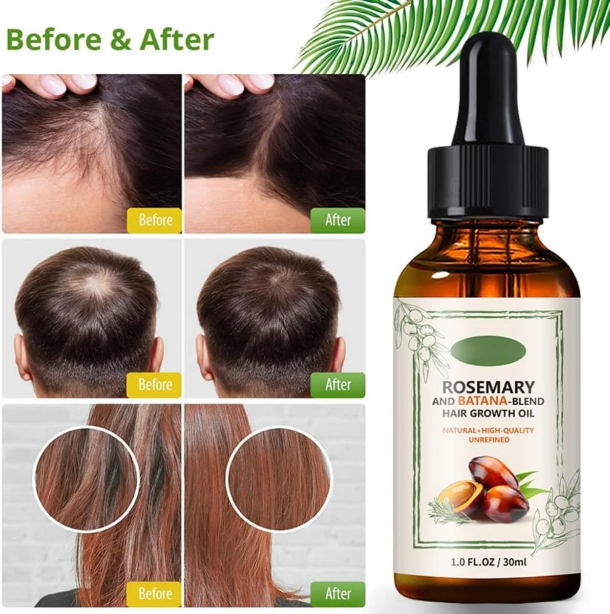 روغن باتانا آزونی برای رشد مو دکتر سبی، 100% خالص و طبیعی هندوراس با رزماری، جلوگیری از ریزش مو، افزایش ضخامت، از بین بردن موخوره و افزایش درخشندگی برای آقایان و بانوان (2 عدد) روغن باتانا آزونی برای رشد مو دکتر سبی، 100% خالص و طبیعی هندوراس با رزماری، جلوگیری از ریزش مو، افزایش ضخامت، از بین بردن موخوره و افزایش درخشندگی برای آقایان و بانوان (2 عدد)