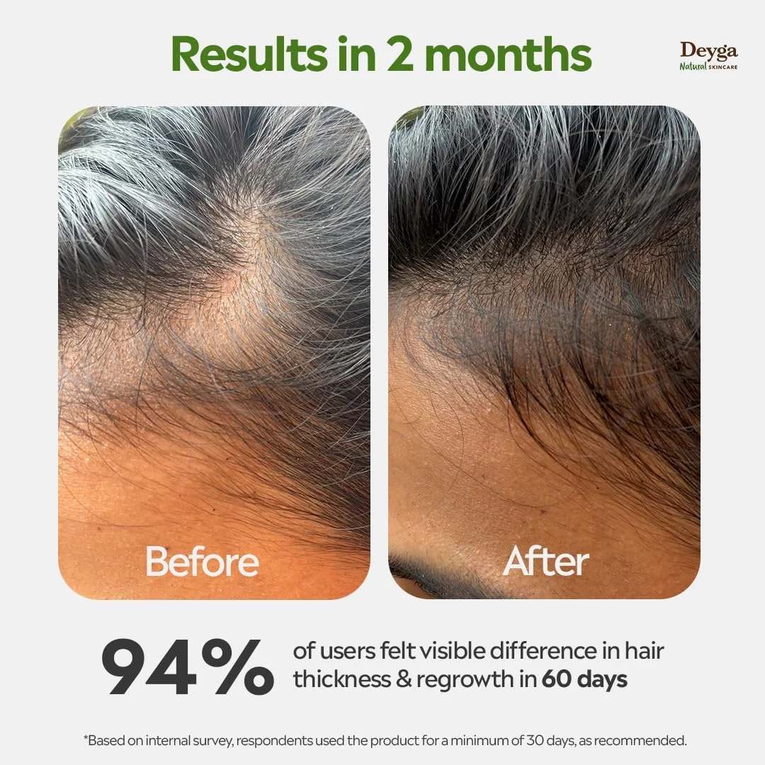 روغن تقویت کننده مو دیگا | افزایش رشد مو | کاهش ریزش مو | ترمیم موهای آسیب دیده | غنی شده با گل بامیه، رزماری و روغن هسته انگور (روغن تقویت کننده مو ۱۰۰ میلی لیتر) | مناسب برای آقایان و بانوان