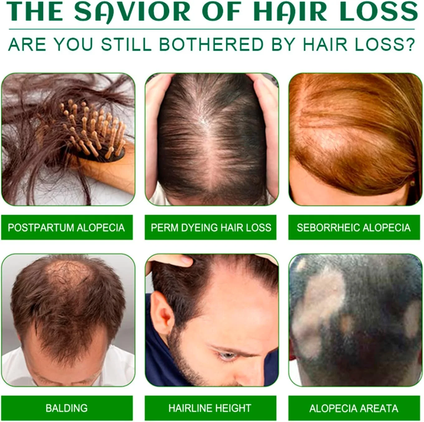 اسپری محلول روغن رشد مو زنجبیلی دیسار بیوتی، مغذی و ترمیم کننده طبیعی ریشه فولیکول مو، حاوی عصاره خربزه و عصاره ریشه جینسینگ، 120 میلی لیتر