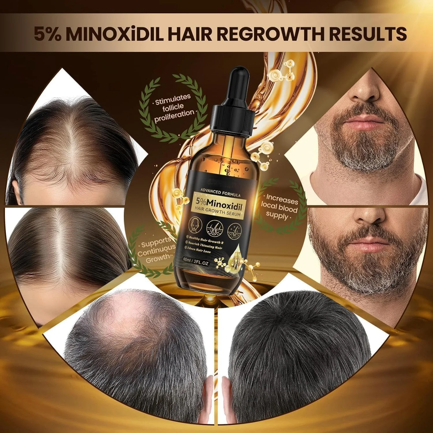 سرم مو برای آقایان و بانوان - روغن مو، اسانس افزایش تراکم مو | اسانس رشد مو، برای آقایان و بانوان