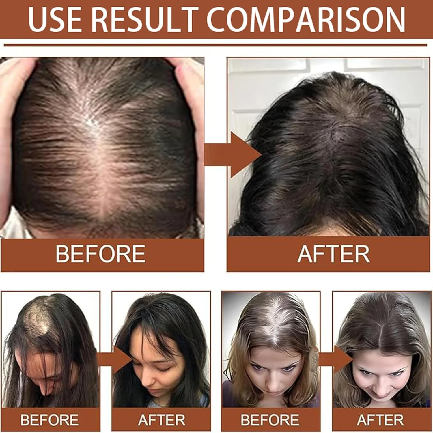 روغن باتانا ارگانیک HIHIDAY برای رشد مو، ۱۰۰٪ طبیعی، نرم کننده باتانا خام از هندوراس، روغن موی ارگانیک برای موهای نازک، ترمیم موهای آسیب دیده، خشک و شکننده (2 عدد)