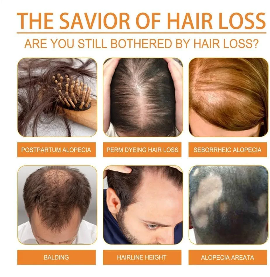 روغن تخم کدو 100% خالص با پرس سرد برای رشد مو و مراقبت از پوست سر - تصفیه نشده، غنی از روی، اسیدهای چرب امگا و آنتی اکسیدان ها - تغذیه کننده پوست سر، تقویت کننده مو، کاهش ریزش