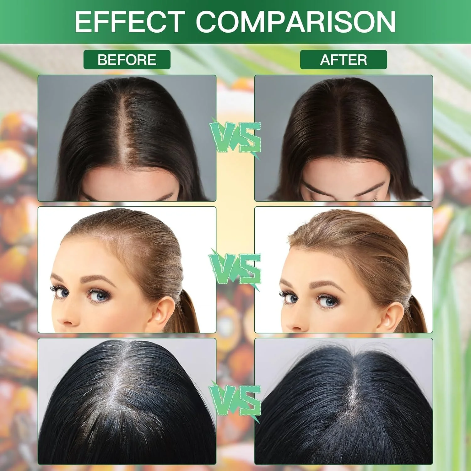 روغن باتانا برای رشد مو، ۱۰۰٪ ارگانیک، ترمیم کننده موهای آسیب دیده، از بین برنده موخوره و افزایش ضخامت مو برای داشتن موهایی سالم تر و پرپشت تر