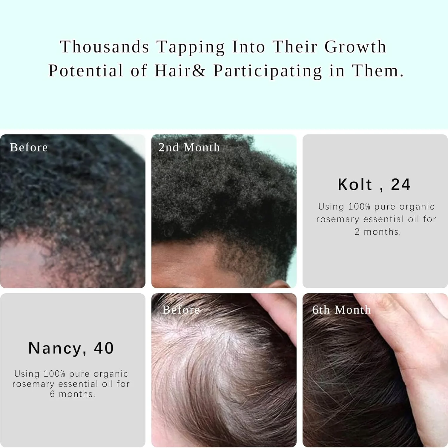 روغن رزماری چند منظوره KPNEMA برای رشد مو، ابرو، مژه، ریش و موهای نازک، تغذیه پوست سر، بهبود گردش خون، 100% روغن خالص ارگانیک طبیعی، بسته 1 عددی، 59.74 میلی لیتر