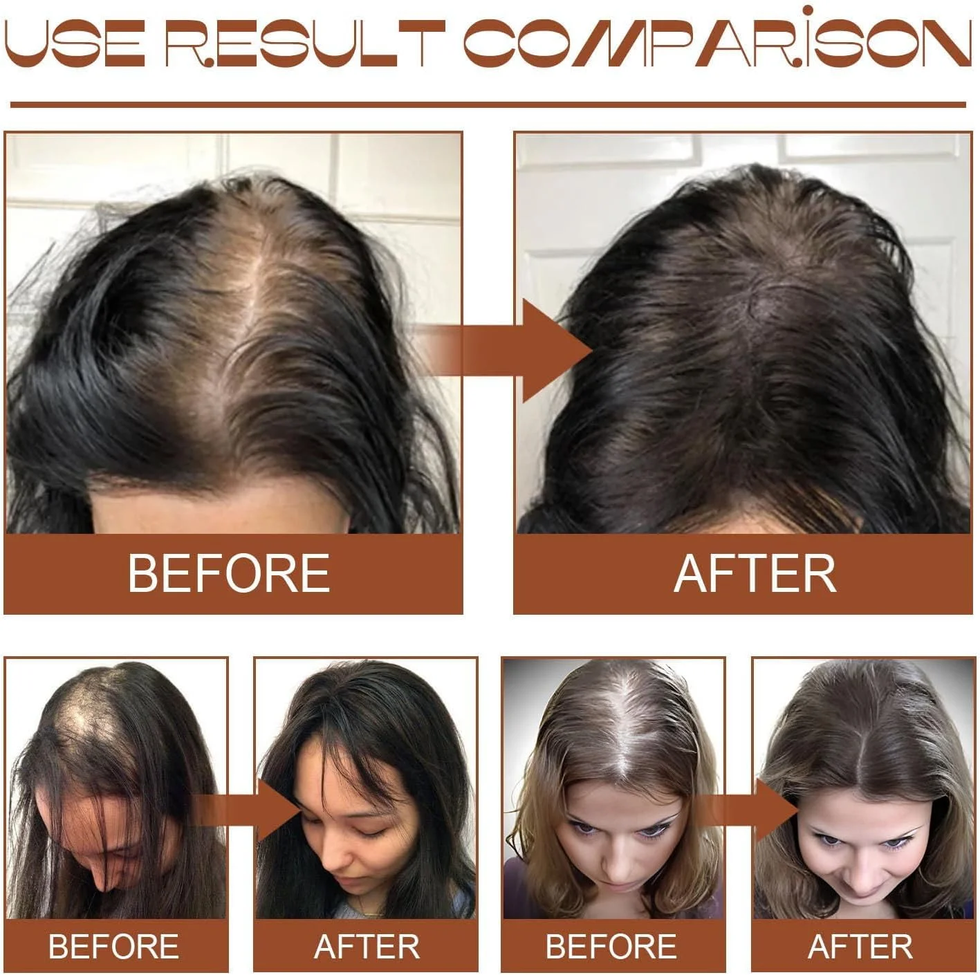 روغن باتانا MEWELL برای رشد مو - ۱۰۰٪ ارگانیک تصفیه نشده برای موهای سالم تر، ضخیم تر و پرپشت تر - هدیه ای عالی برای خانم ها و آقایان