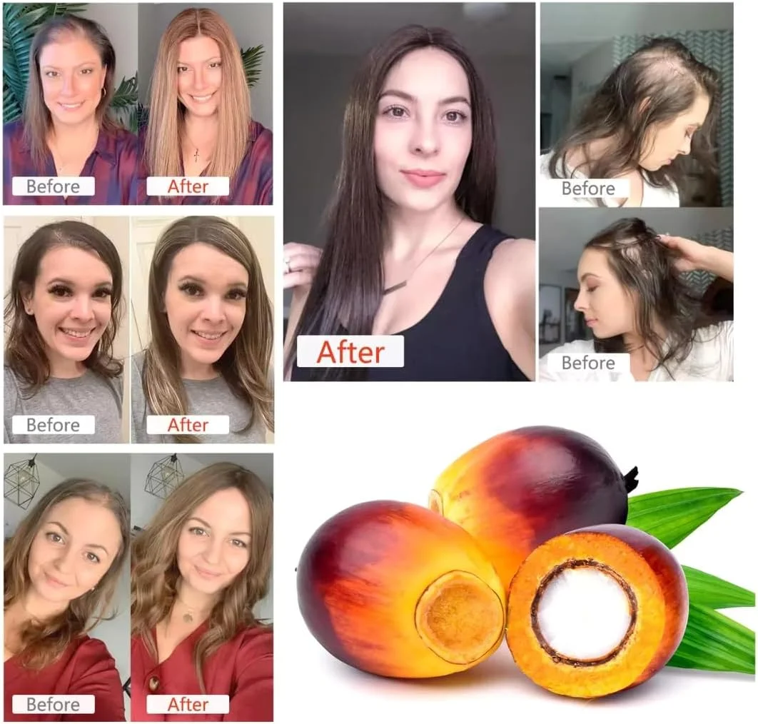 روغن معجزه آسای باتانا NIKITA.VIVI برای رشد مو و مراقبت از پوست، 60 میلی لیتر، روغن باتانای ضروری پیشرفته 100% طبیعی ارگانیک پرس سرد برای رشد مو، تقویت، مرطوب کردن و آبرسانی مو و پوست سر