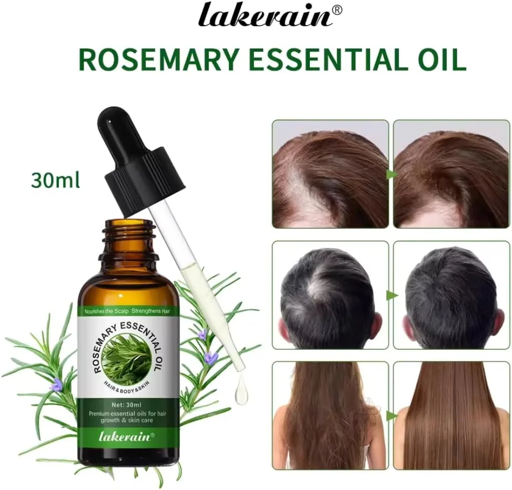 NIKITA.VIVI - Rosemary Essential Oil 30ml | Rosemary Oil for Hair Growth Serum | 100% Pure Natural & Organic Rosemary Oil for Dry Damaged Hair | Hair Growth Scalp Oil | Hair Loss Treatment Serum Oil