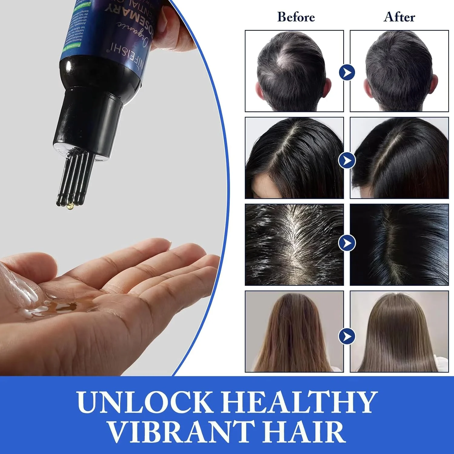 روغن رزماری و کرچک NIKITA.VIVI برای رشد مو و مراقبت از پوست 120 میلی لیتر، 100% خالص و ارگانیک، غنی شده با روغن رزماری، بهبود گردش خون، تغذیه پوست سر و جلوگیری از شکستگی مو