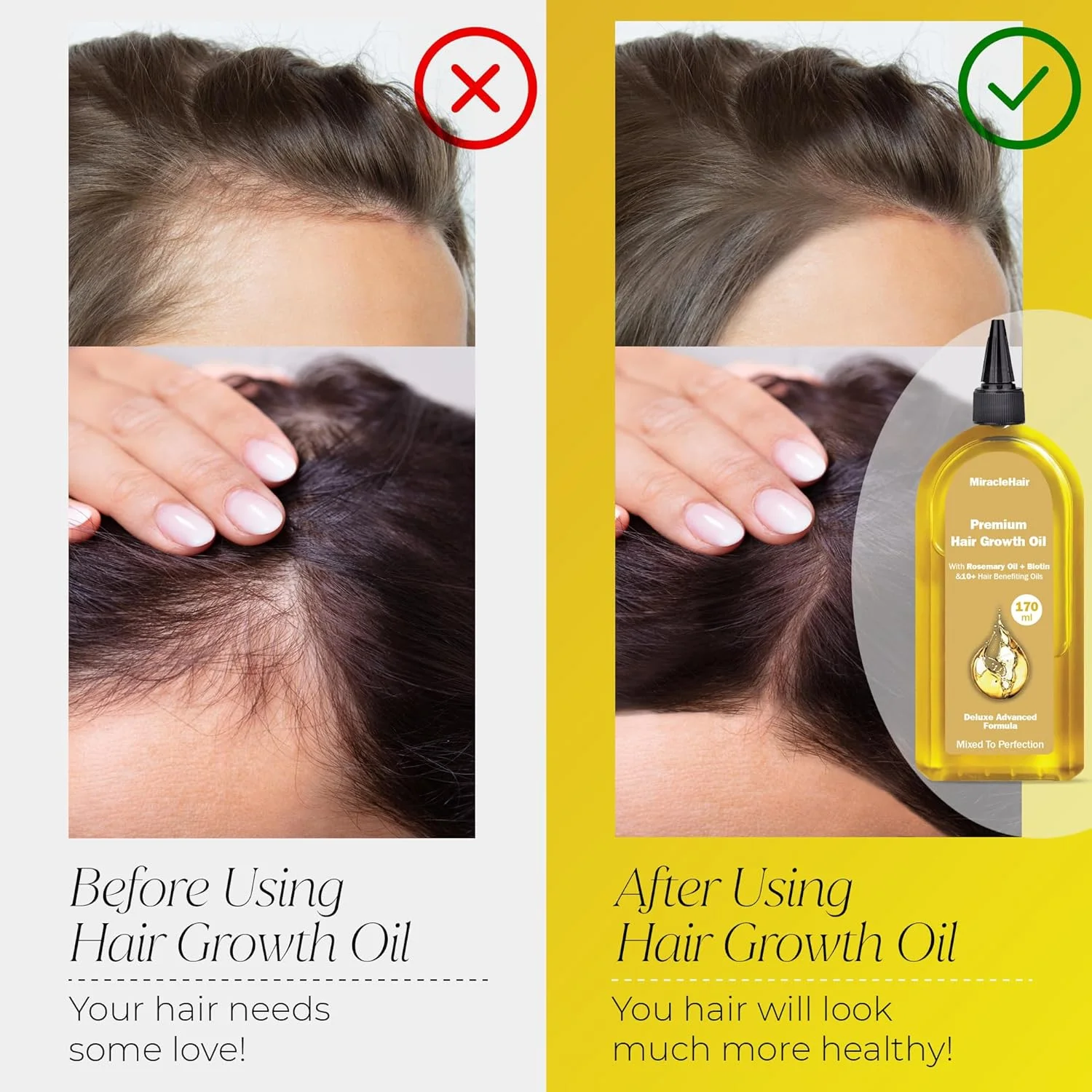 Premium Hair Growth Oil 170ml – Enriched with Rosemary, Biotin, and 10 Natural Oils for Enhanced Hair Growth and Thickness