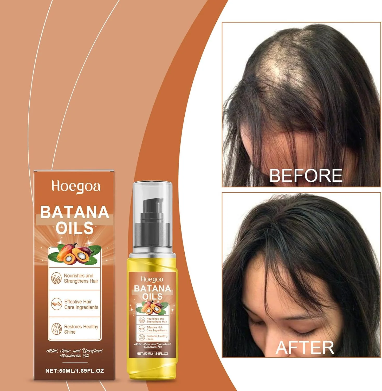 روغن باتانا برای رشد مو، ترکیب 4 در 1 با رزماری، کرچک و دانه کدو تنبل. به طور عمیق موهای آسیب دیده را ترمیم می کند، رشد جدید را تحریک می کند، درخشندگی را افزایش می دهد و موها را با هر بار استفاده ضخیم تر می کند.