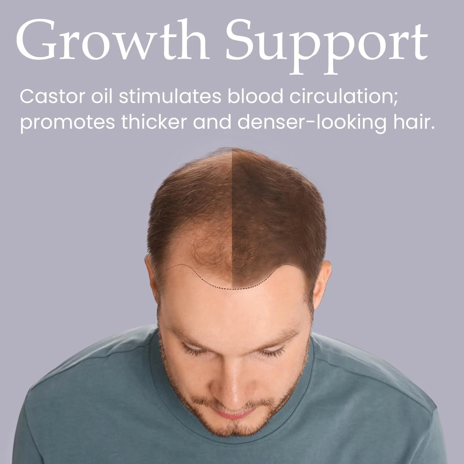 روغن موی مردانه کرونینگ گلوری ۱۰۰ میلی لیتر - روغن دانه کدو تنبل برای ریزش مو - سم زدایی پوست سر - تقویت رشد موهای قوی تر