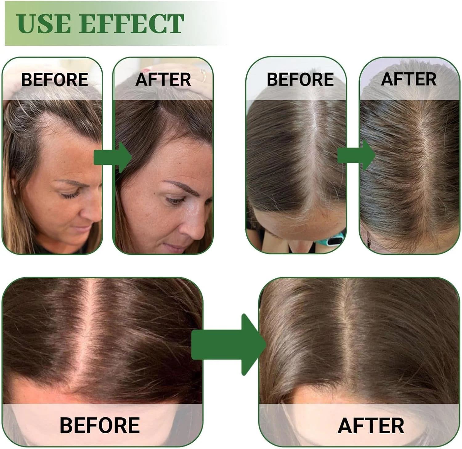 مجموعه تقویت کننده مو رزماری، شامل روغن رشد مو، اسپری و سرم غلطکی برای موهای ضخیم تر و پرپشت تر، مناسب برای انواع مو، تقویت کننده رشد سالم مو برای آقایان و بانوان