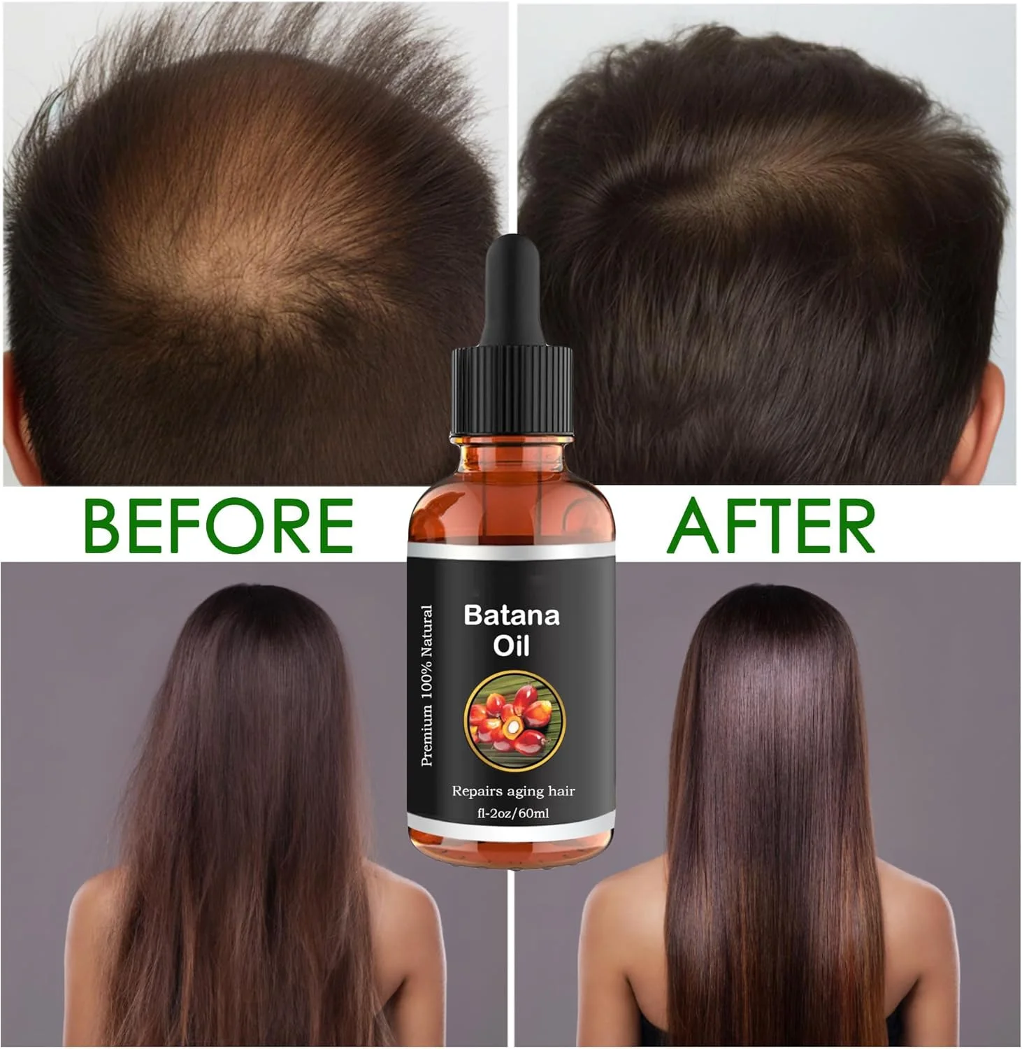 2Pcs Organic Batana Oil for Hair Growth, Pure Organic Hair Growth Solution from Honduras, Promotes Hair Wellness for Men & Women, Enhances Hair & Skin Radiance (2.0 Oz)