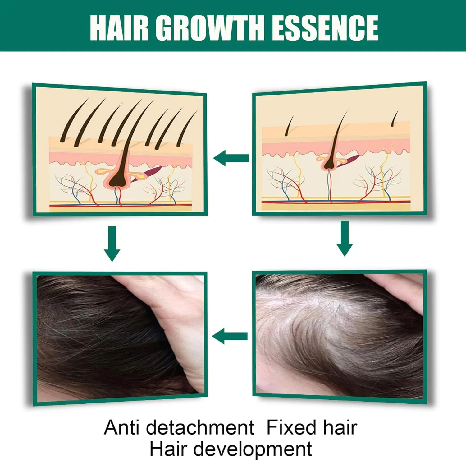 روغن درمان مو زنجبیلی برای رشد مو، روغن ضروری زنجبیل طبیعی خالص، ترمیم موهای آسیب دیده، خشک و شکننده، کنترل ریزش مو (30 میلی لیتر، زنجبیل)