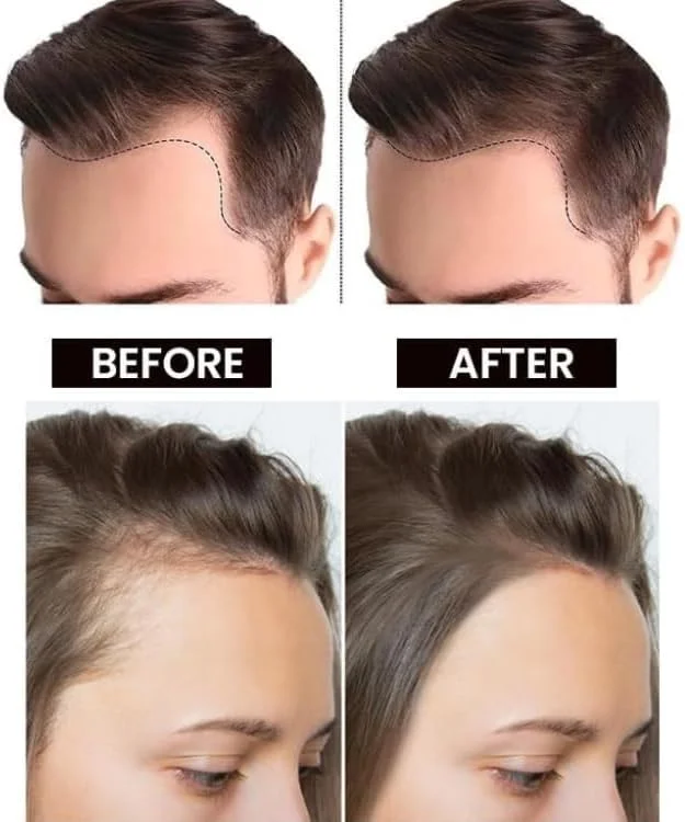 سرم روغن سیر سیاه لوس بین، تقویت کننده تارهای مو و جلوگیری از ریزش مو با حمایت از فولیکول های مو و ترمیم موهای ضعیف (50, 2)