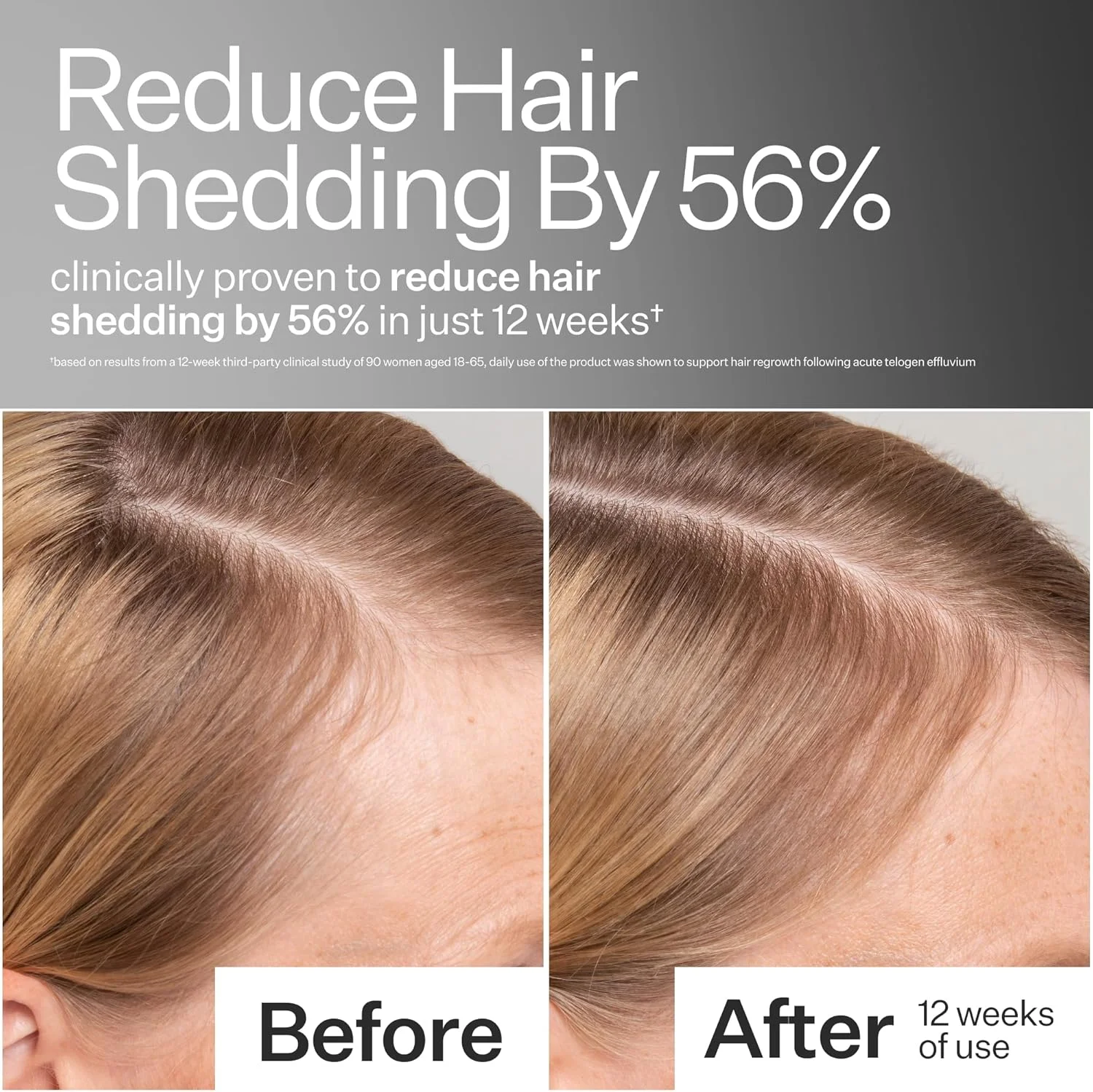 سرم پوست سر سلول بنیادی سیب فرآوری شده با سرما ACT+ ACRE - محرک رشد و کاهش ریزش مو - تسکین دهنده و آبرسان پوست سر - فاقد سولفات و پارابن - آلوئه ورا برای بهبود سلامت پوست سر.