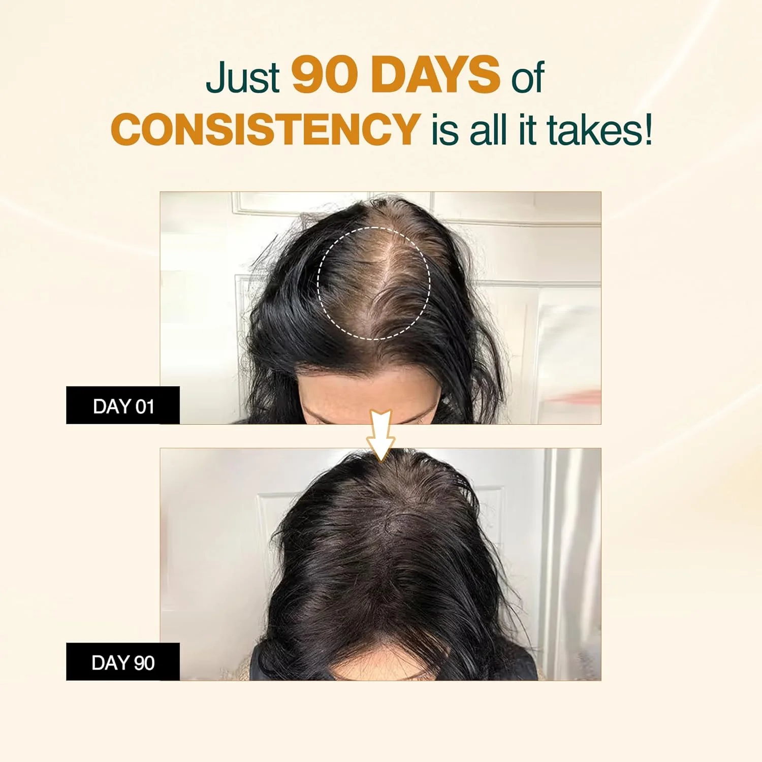 سرم پیشرفته رشد مو Nourish Mantra، ۵۰ میلی لیتر، حاوی ۳% Redensyl، ۲% Anagain، ۲% Procapil و ۵% آب برنج، محرک رشد مجدد مو، درمان ضد ریزش و نازک شدن مو، سرم رشد سریع مو برای بانوان و آقایان