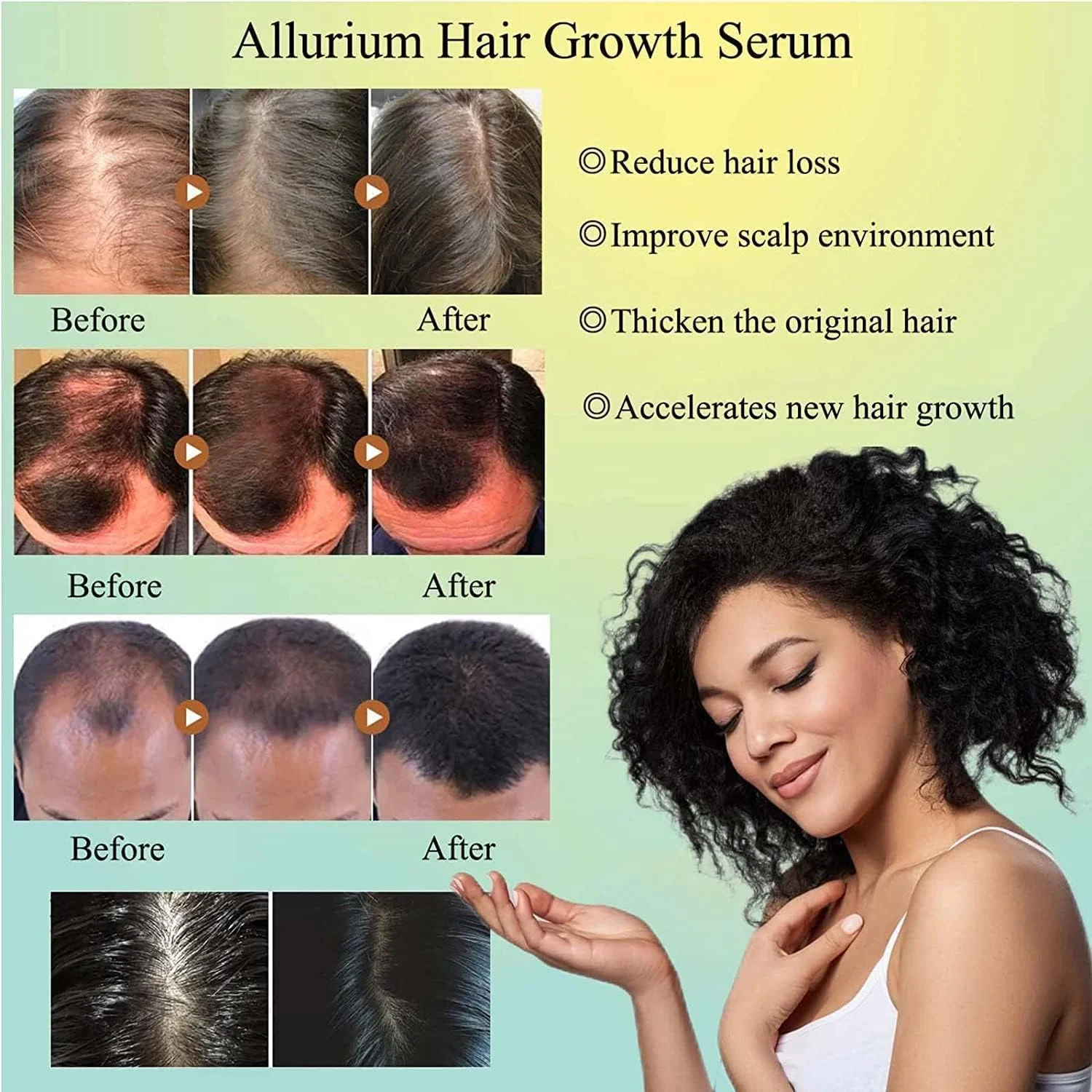 سرم رشد مو آلیوریوم برای موهای مشکی، سرم زیبایی آلیوریوم، تغذیه و ترمیم موهای خشک و آسیب دیده و جلوگیری از ریزش مو برای انواع مو (3 عدد)