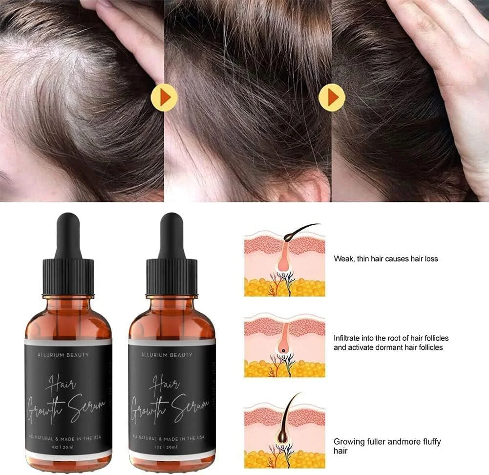 سرم رشد مو آلیوریوم برای موهای مشکی، سرم رشد مو آلیوریوم بیوتی، تغذیه و ترمیم موهای خشک و آسیب دیده و جلوگیری از ریزش مو برای انواع مو (2 عدد)