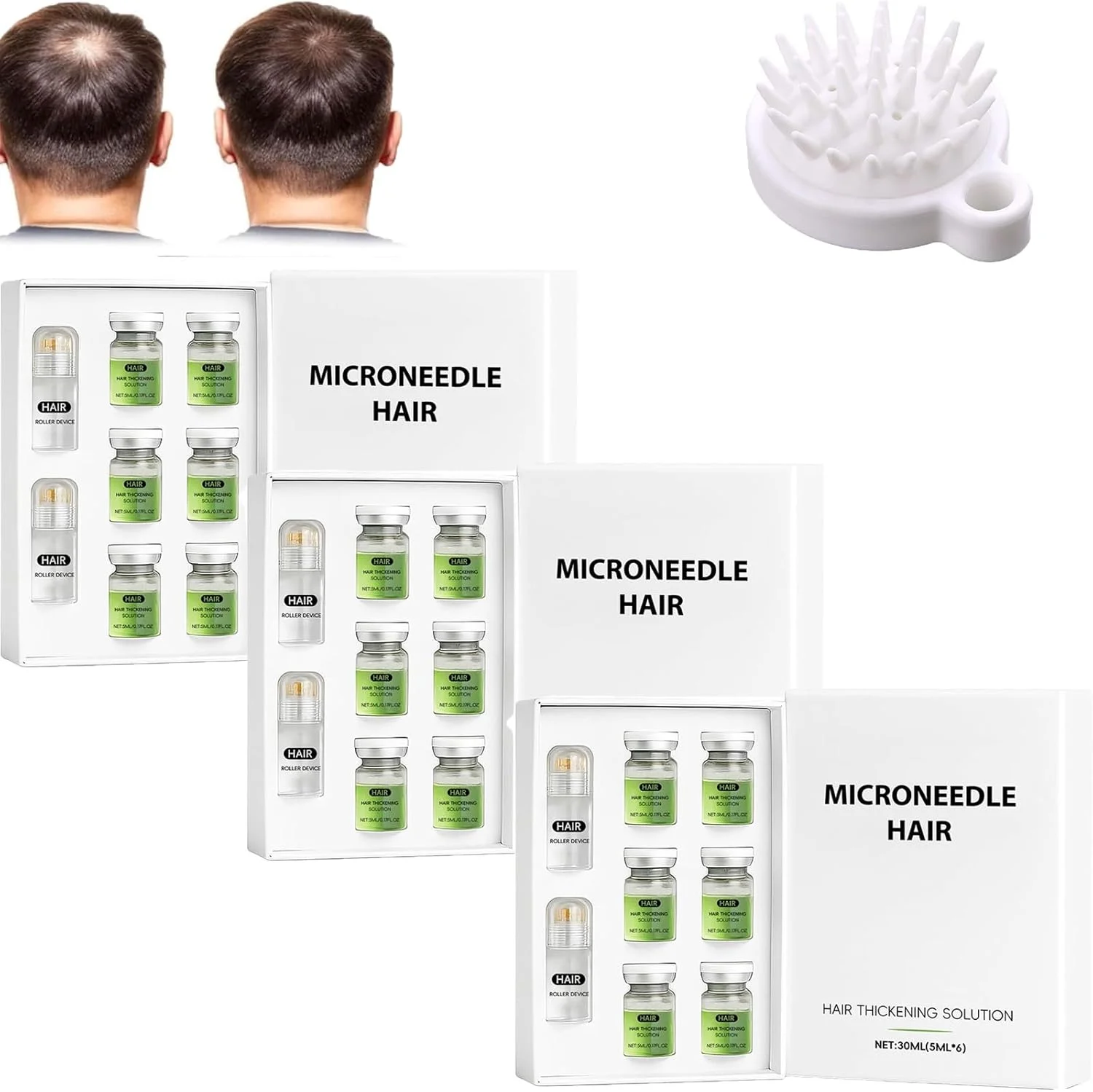 مجموعه پیشرفته تقویت مو آلفا اینفیوز، سرم درمان رشد مو برای موهای ضخیم تر و پرپشت تر، تقویت کننده ریشه، ملایم و بدون درد، پشتیبانی از رشد موهای سالم برای آقایان و بانوان (3 عدد) مجموعه پیشرفته تقویت مو آلفا اینفیوز، سرم درمان رشد مو برای موهای ضخیم تر و پرپشت تر، تقویت کننده ریشه، ملایم و بدون درد، پشتیبانی از رشد موهای سالم برای آقایان و بانوان (3 عدد)