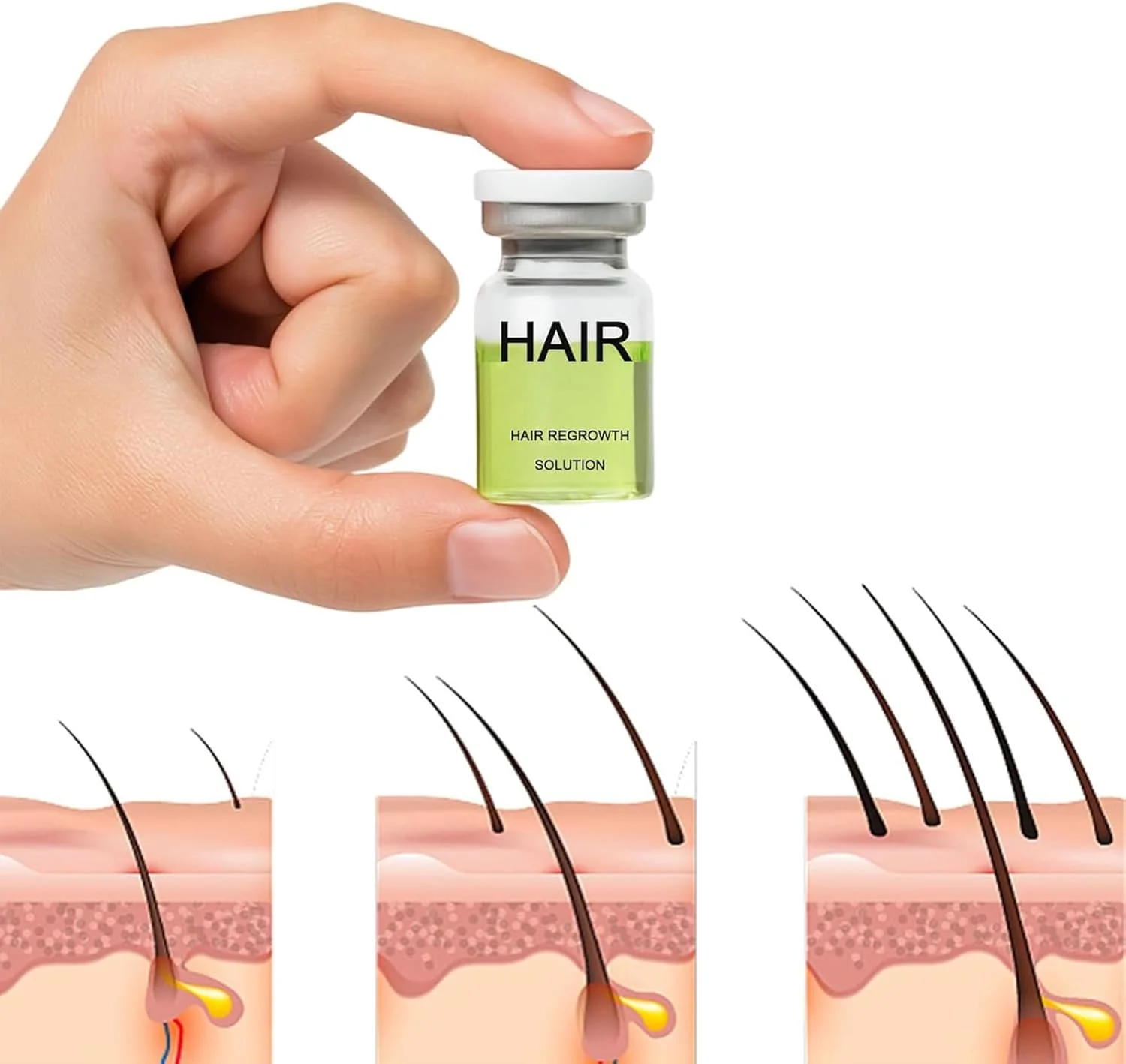 مجموعه پیشرفته تقویت مو آلفا اینفیوز، سرم درمان رشد مو برای موهای ضخیم تر و پرپشت تر، تقویت کننده ریشه، ملایم و بدون درد، پشتیبانی از رشد موهای سالم برای آقایان و بانوان (3 عدد) مجموعه پیشرفته تقویت مو آلفا اینفیوز، سرم درمان رشد مو برای موهای ضخیم تر و پرپشت تر، تقویت کننده ریشه، ملایم و بدون درد، پشتیبانی از رشد موهای سالم برای آقایان و بانوان (3 عدد)