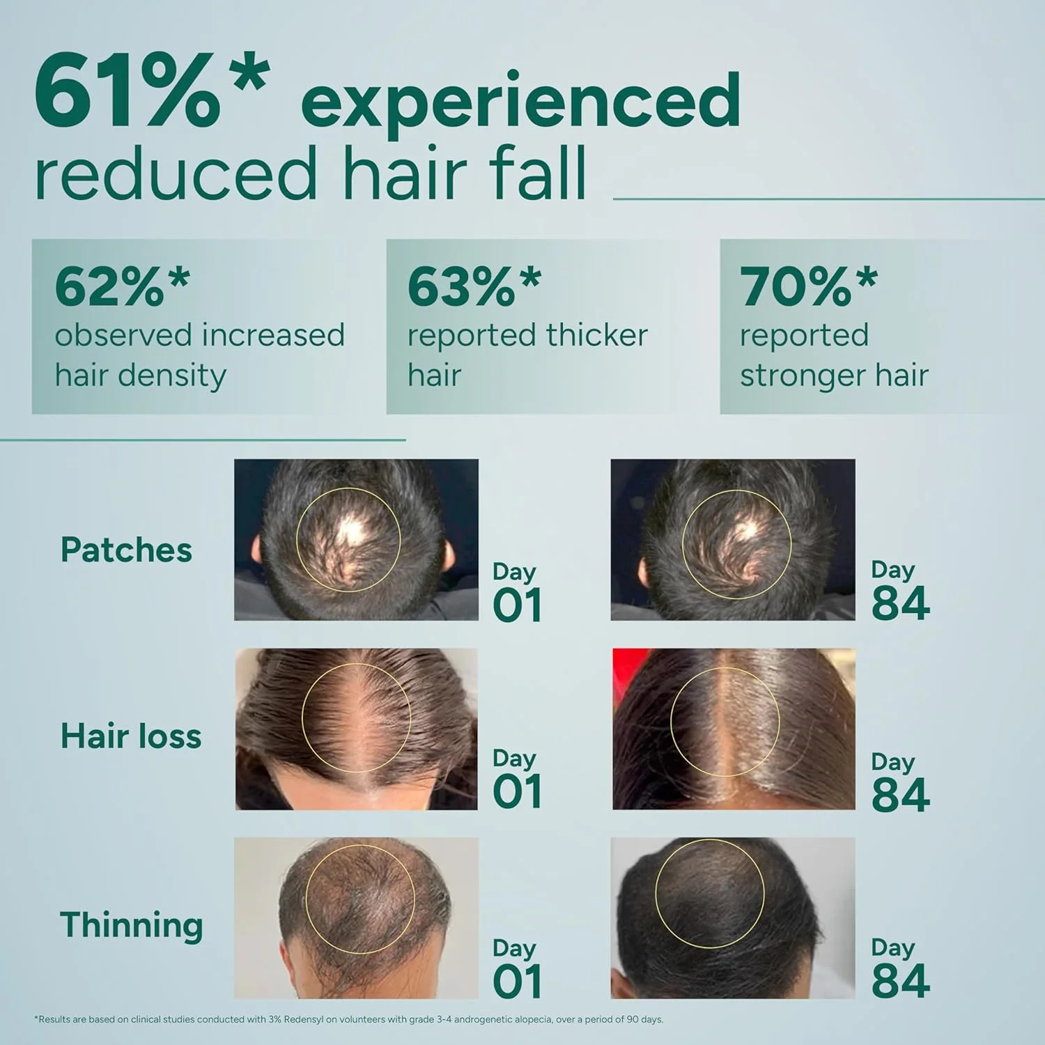 سرم تقویت کننده مو آرata با 3% Redensyl، 3% Procapil، پیاز، زردچوبه، آب برنج | کنترل ریزش مو، تحریک رشد مو، افزایش تراکم مو | سرم رشد مو برای آقایان و بانوان | سرم تقویت کننده مو آرata با 3% Redensyl، 3% Procapil، پیاز، زردچوبه، آب برنج | کنترل ریزش مو، تحریک رشد مو، افزایش تراکم مو | سرم رشد مو برای آقایان و بانوان |