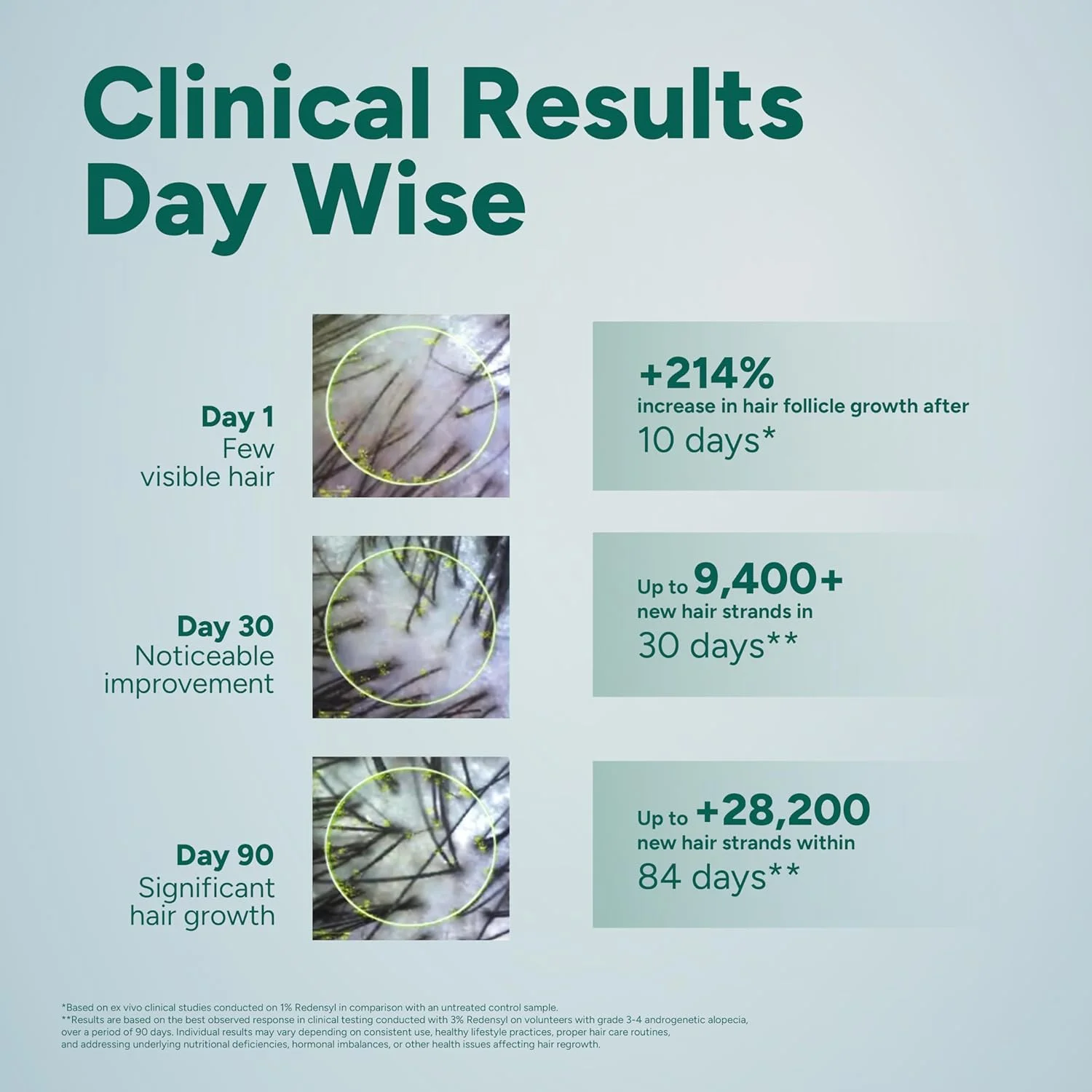سرم تقویت کننده مو آرata با 3% Redensyl، 3% Procapil، پیاز، زردچوبه، آب برنج | کنترل ریزش مو، تحریک رشد مو، افزایش تراکم مو | سرم رشد مو برای آقایان و بانوان | سرم تقویت کننده مو آرata با 3% Redensyl، 3% Procapil، پیاز، زردچوبه، آب برنج | کنترل ریزش مو، تحریک رشد مو، افزایش تراکم مو | سرم رشد مو برای آقایان و بانوان |