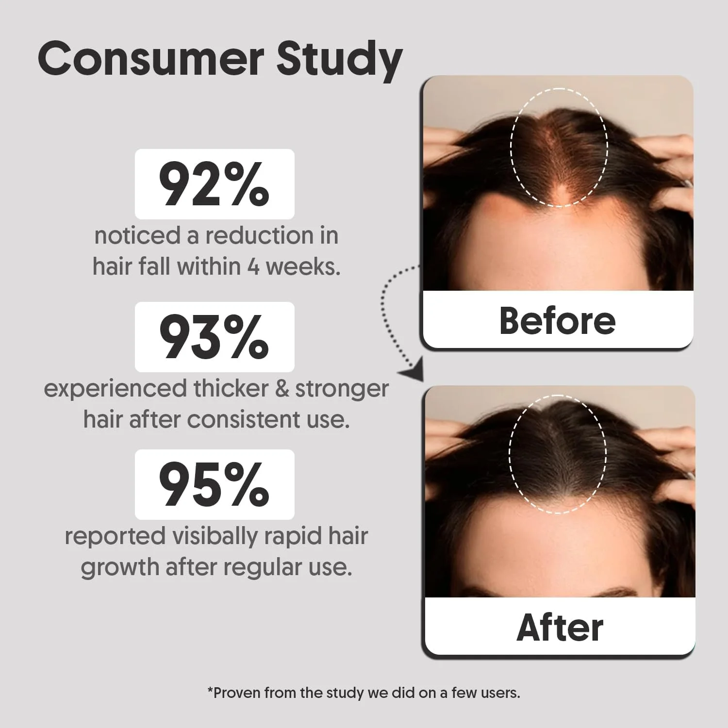 سرم رشد موی آراوی ارگانیک با 3% Redensyl، 2% Anagain، 2% Procapil - برای رشد مو و کنترل ریزش مو - برای آقایان و بانوان - 30 میلی لیتر سرم رشد موی آراوی ارگانیک با 3% Redensyl، 2% Anagain، 2% Procapil - برای رشد مو و کنترل ریزش مو - برای آقایان و بانوان - 30 میلی لیتر