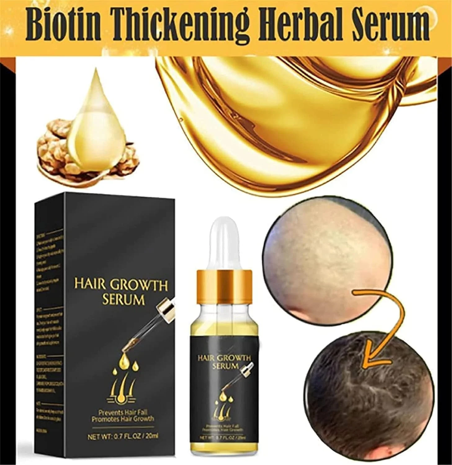 سرم گیاهی ضخیم کننده مو بیوتین AUDBUA، سرم گیاهی بیوتین اضافی، روغن اسانس رشد سریع مو زنجبیل برای انواع مو (2 عدد) سرم گیاهی ضخیم کننده مو بیوتین AUDBUA، سرم گیاهی بیوتین اضافی، روغن اسانس رشد سریع مو زنجبیل برای انواع مو (2 عدد)