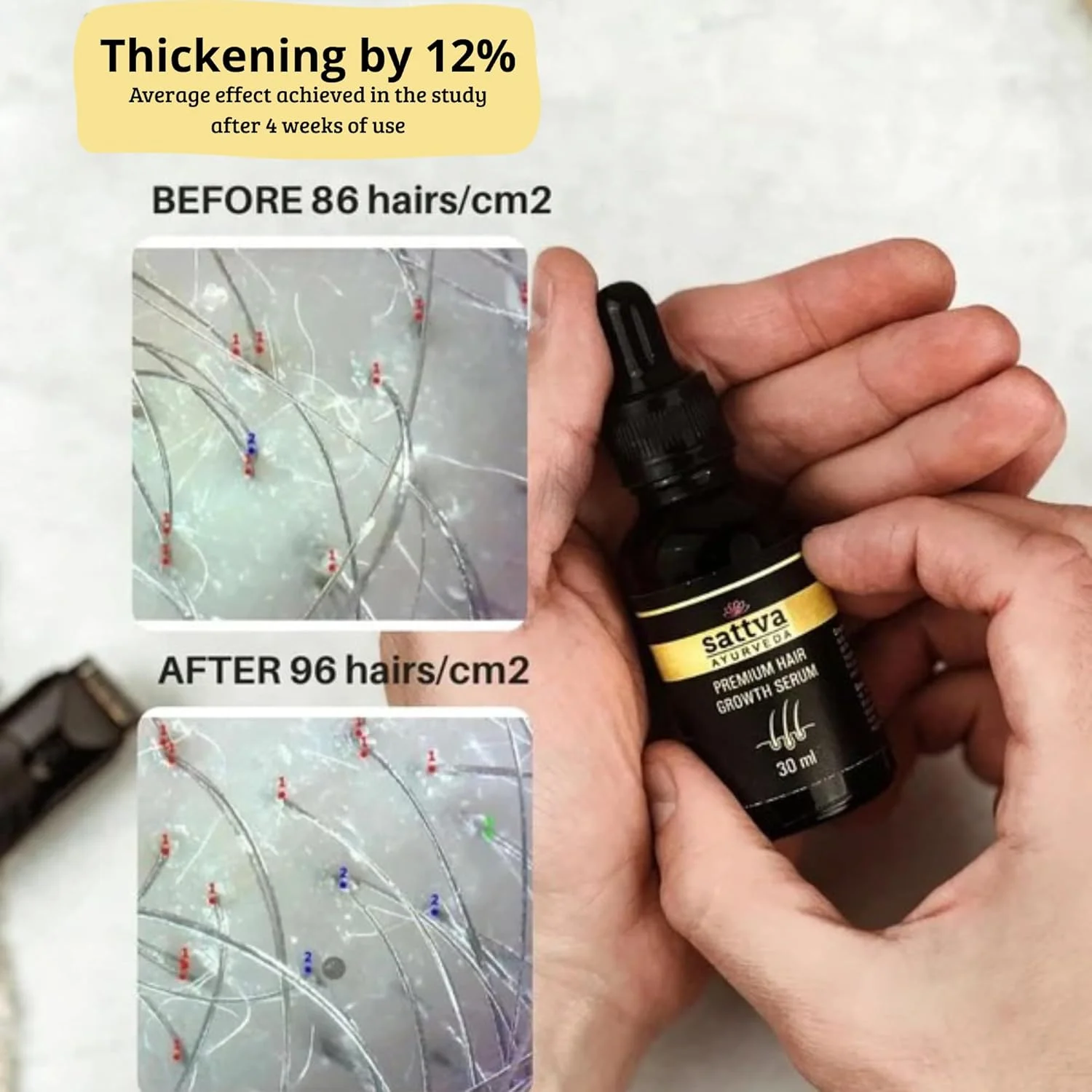 سرم تقویت کننده مو Sattva Ayurveda Premium، سرم رشد مو برای زنان و مردان، عوامل نوآورانه رشد مو، تسریع رشد مو و مقابله با ریزش مو با عصاره رزماری، Redensyl® سرم تقویت کننده مو Sattva Ayurveda Premium، سرم رشد مو برای زنان و مردان، عوامل نوآورانه رشد مو، تسریع رشد مو و مقابله با ریزش مو با عصاره رزماری، Redensyl®