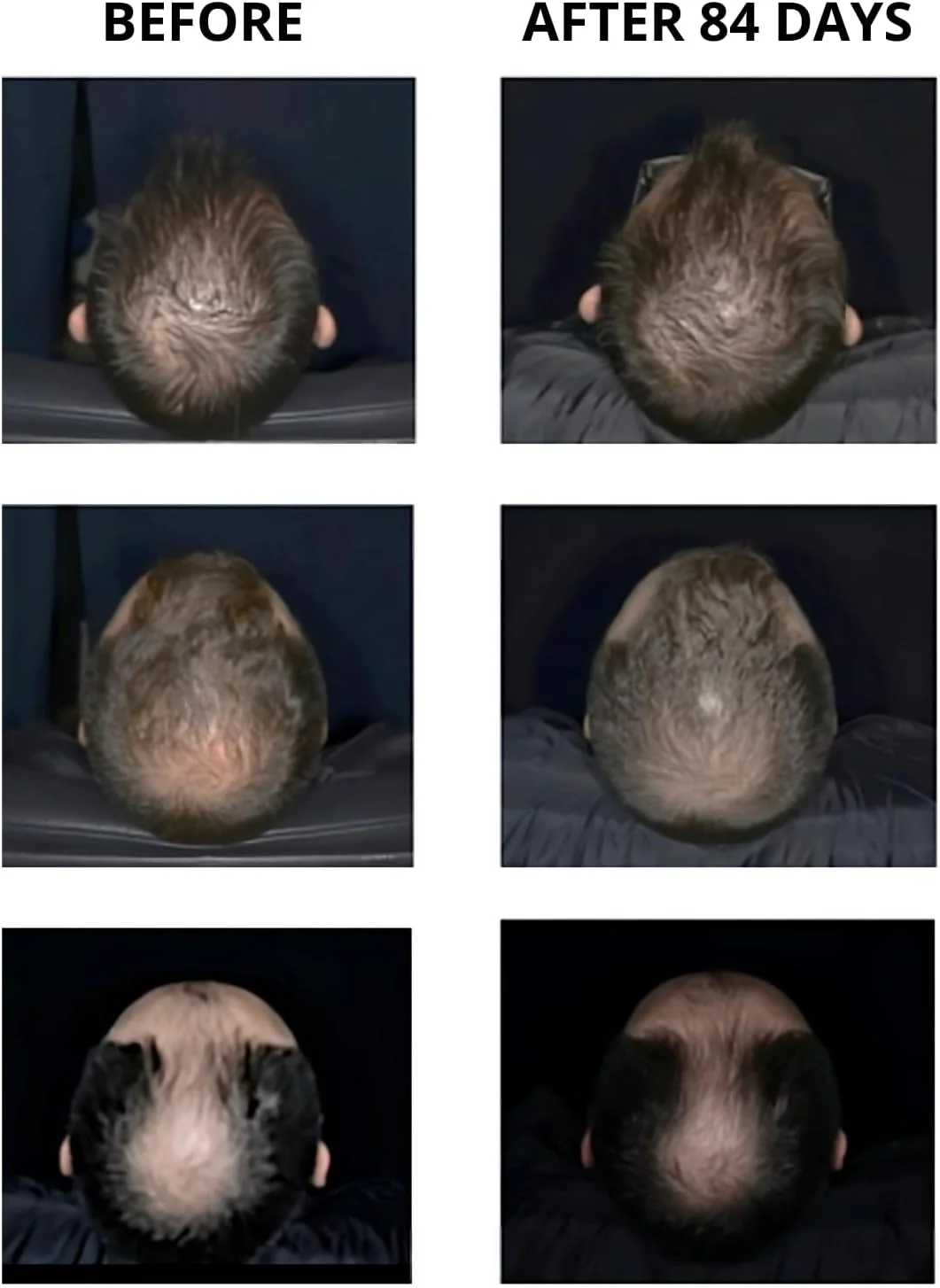 سرم تقویت کننده مو Sattva Ayurveda Premium، سرم رشد مو برای زنان و مردان، عوامل نوآورانه رشد مو، تسریع رشد مو و مقابله با ریزش مو با عصاره رزماری، Redensyl® سرم تقویت کننده مو Sattva Ayurveda Premium، سرم رشد مو برای زنان و مردان، عوامل نوآورانه رشد مو، تسریع رشد مو و مقابله با ریزش مو با عصاره رزماری، Redensyl®