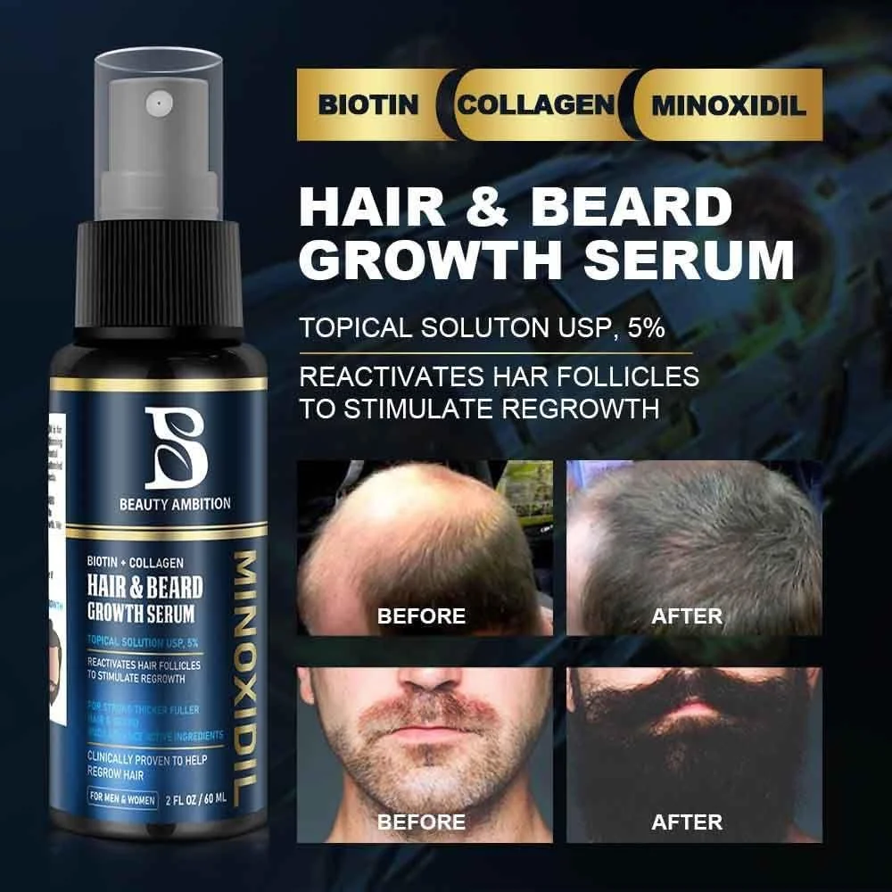 سرم رشد مو و ریش بیوتی امبیشن حاوی 5% محلول 60 میلی لیتر سرم رشد مو و ریش بیوتی امبیشن حاوی 5% محلول 60 میلی لیتر