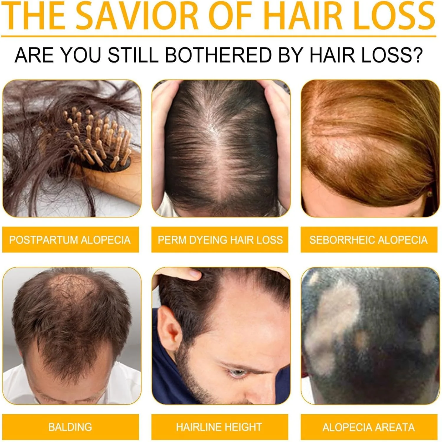 سرم رشد مو لوکس بیوتین بیانکات 30 میلی لیتر، سرم تسریع کننده رشد مو برای زنان و مردان