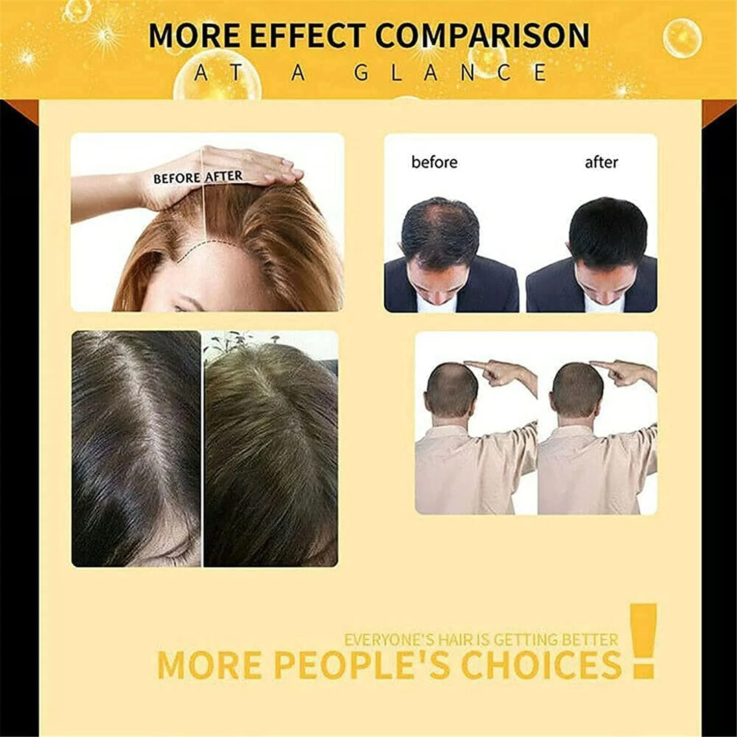 سرم تقویت کننده مو بیوتین، سرم گیاهی بیوتین اضافی، برای کمک به رشد موهای سالم و قوی مناسب برای مردان و زنان با انواع مو (3 عدد) سرم تقویت کننده مو بیوتین، سرم گیاهی بیوتین اضافی، برای کمک به رشد موهای سالم و قوی مناسب برای مردان و زنان با انواع مو (3 عدد)