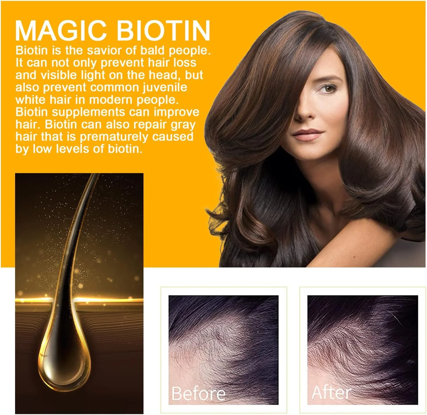 اسپری رشد مو بیوتین، اسپری بیوتین برای رشد مو، سرم گیاهی ضخیم کننده بیوتین، سرم اسپری رشد مو بیوتین، روغن های ضروری رشد مو، تغذیه کننده مو و پوست سر (5 عدد)