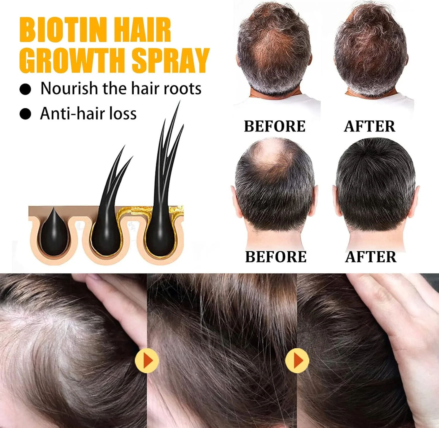 اسپری رشد مو بیوتین، اسپری بیوتین برای رشد مو، سرم گیاهی ضخیم کننده بیوتین، سرم اسپری رشد مو بیوتین، روغن های ضروری رشد مو، تغذیه کننده مو و پوست سر (5 عدد)