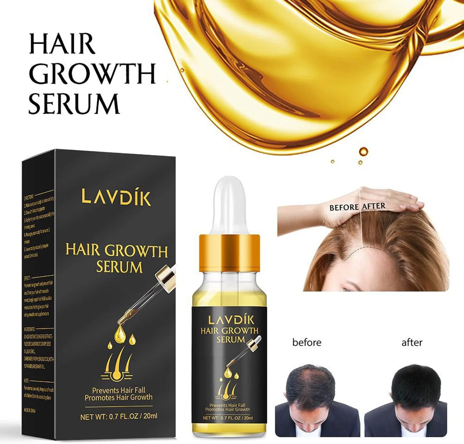 سرم گیاهی ضخیم کننده مو حاوی بیوتین، سرم گیاهی اضافی بیوتین، روغن اسانس زنجبیل برای رشد مو مناسب انواع مو برای آقایان و بانوان