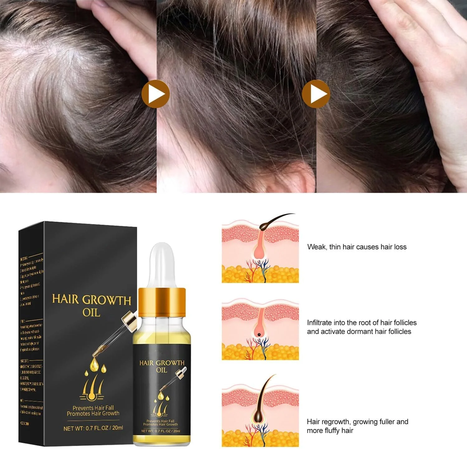 سرم گیاهی ضخیم کننده بیوتین، روغن تقویت کننده مو، سرم گیاهی بیوتین اضافی، اسانس گیاهی رشد مو، روغن اسانس سرم زنجبیل برای رشد مو برای انواع مو (1 عدد)