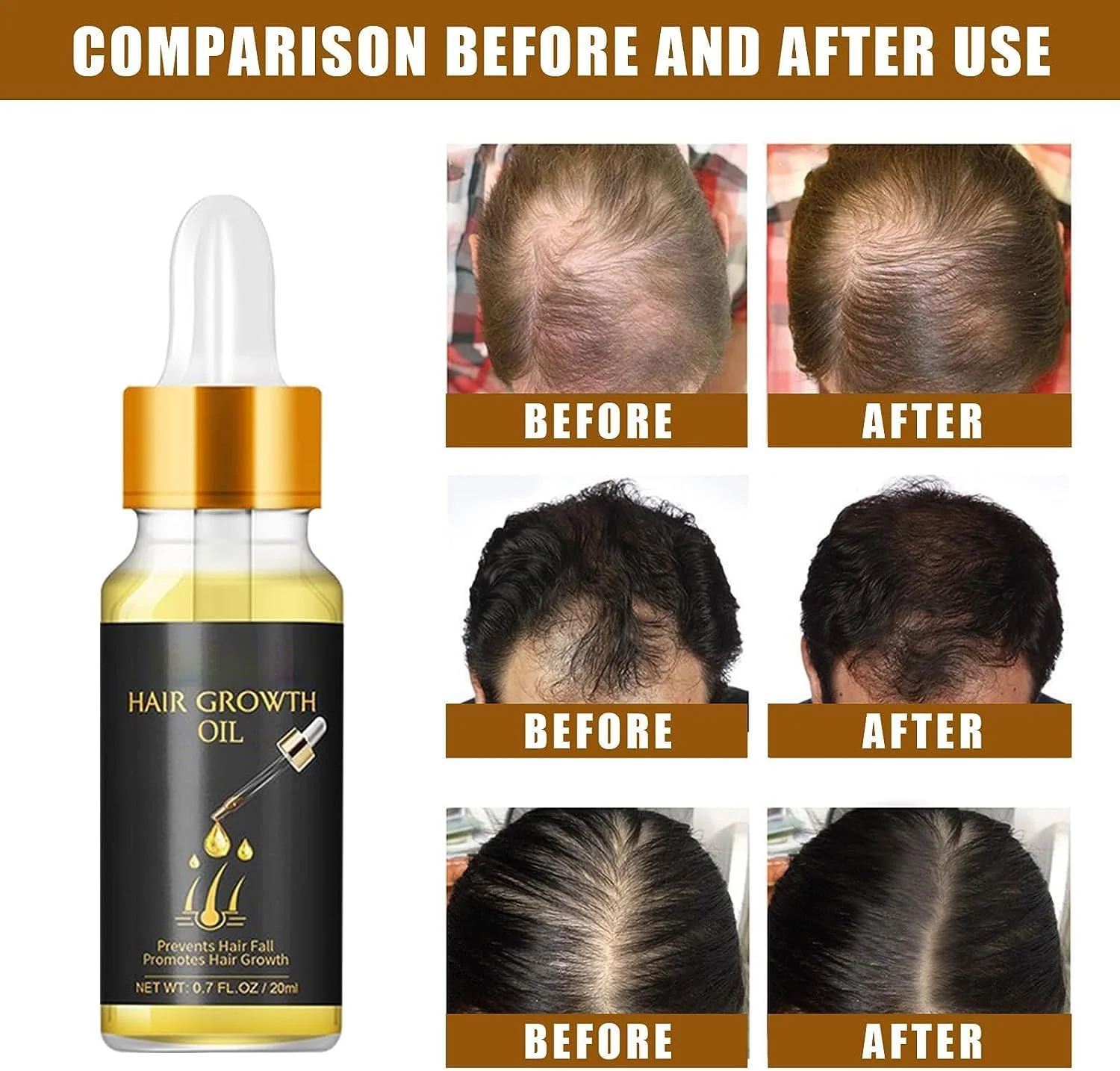 سرم گیاهی ضخیم کننده بیوتین، روغن تقویت کننده مو، سرم گیاهی بیوتین اضافی، اسانس گیاهی رشد مو، روغن اسانس سرم زنجبیل برای رشد مو برای انواع مو (1 عدد)