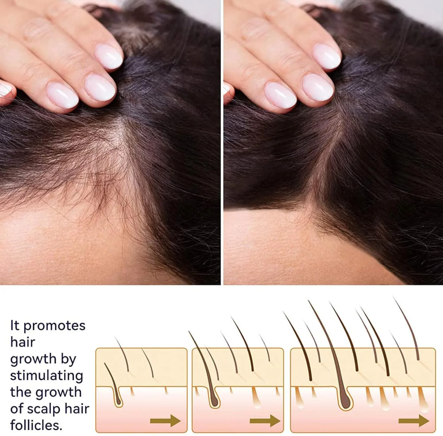 اسپری سرم فرمول رشد مو بلوسومز، اسپری رشد مو آشواگاندا 4500، اسپری رشد مو بلوسومز، تقویت کننده موهای ضخیم تر و قوی تر برای آقایان و بانوان (2 عدد)