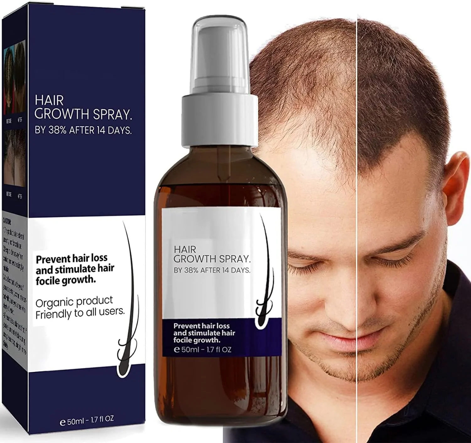 اسپری سرم فرمول رشد مو بلوسومز، اسپری رشد مو آشواگاندا 4500، سرم مو برای موهای خشک و آسیب دیده (1 عدد)