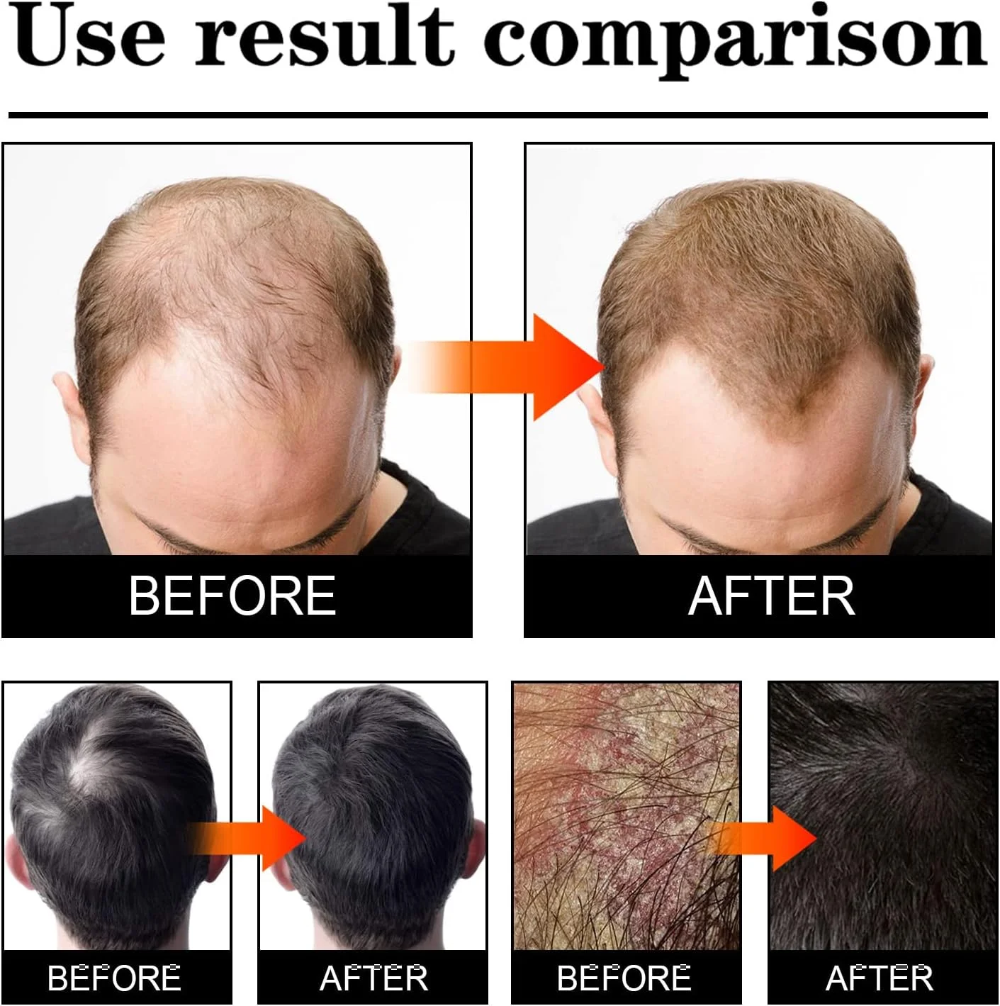 اسپری ضد ریزش مو بلوسومز، اسپری سرم فرمول رشد مو بلوسومز، اسپری اسانس گیاهی طبیعی رشد مو، برای مردان و زنان (3 عدد)