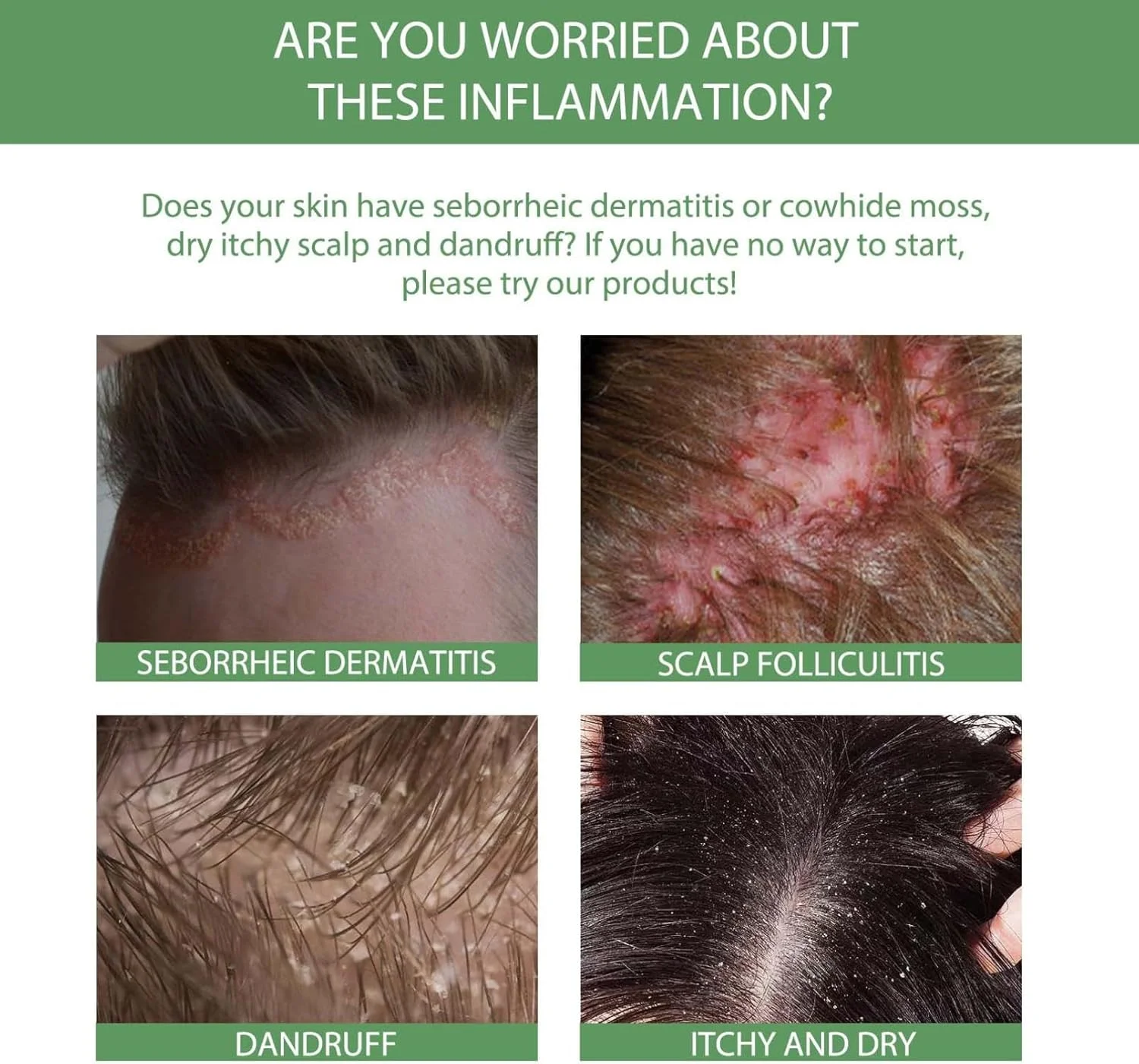 اسپری ترمیم کننده پوست سر موی زیتون بلوسومز، اسپری سرم فرمول رشد مو بلوسومز، اسپری مو روغن زیتون، اسپری زنجبیل مغذی رشد مجدد، روغن سرم رشد مو برای رشد موهای خشک و آسیب دیده (2 عدد)