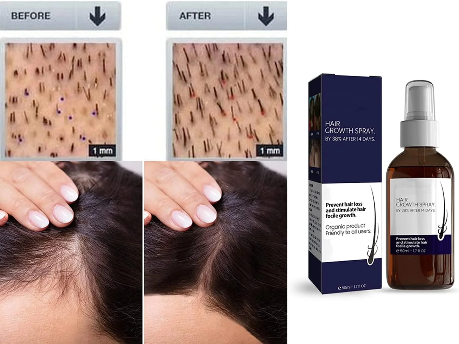 اسپری سرم فرمول رشد مو بلوسومز، اسپری رشد مو آشواگاندا 4500، سرم رشد مو بلوسومز برای موهای خشک، وز و آسیب دیده (3 عدد) اسپری سرم فرمول رشد مو بلوسومز، اسپری رشد مو آشواگاندا 4500، سرم رشد مو بلوسومز برای موهای خشک، وز و آسیب دیده (3 عدد)