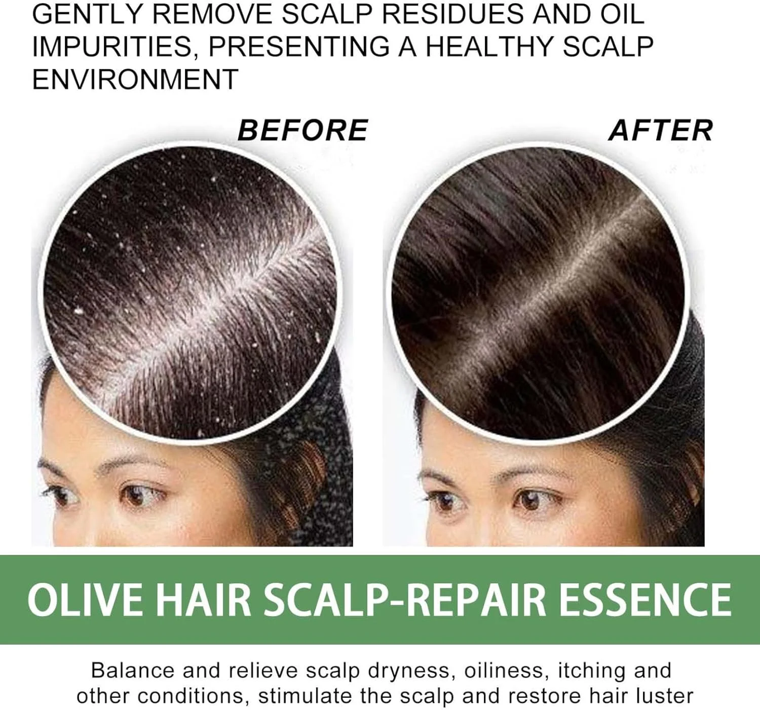 اسپری ترمیم کننده پوست سر موی زیتون بلوسومز، اسپری سرم فرمول رشد مو بلوسومز، اسپری مو روغن زیتون، اسپری زنجبیل مغذی رشد مجدد، روغن سرم رشد مو برای رشد موهای خشک و آسیب دیده (3 عدد) اسپری ترمیم کننده پوست سر موی زیتون بلوسومز، اسپری سرم فرمول رشد مو بلوسومز، اسپری مو روغن زیتون، اسپری زنجبیل مغذی رشد مجدد، روغن سرم رشد مو برای رشد موهای خشک و آسیب دیده (3 عدد)